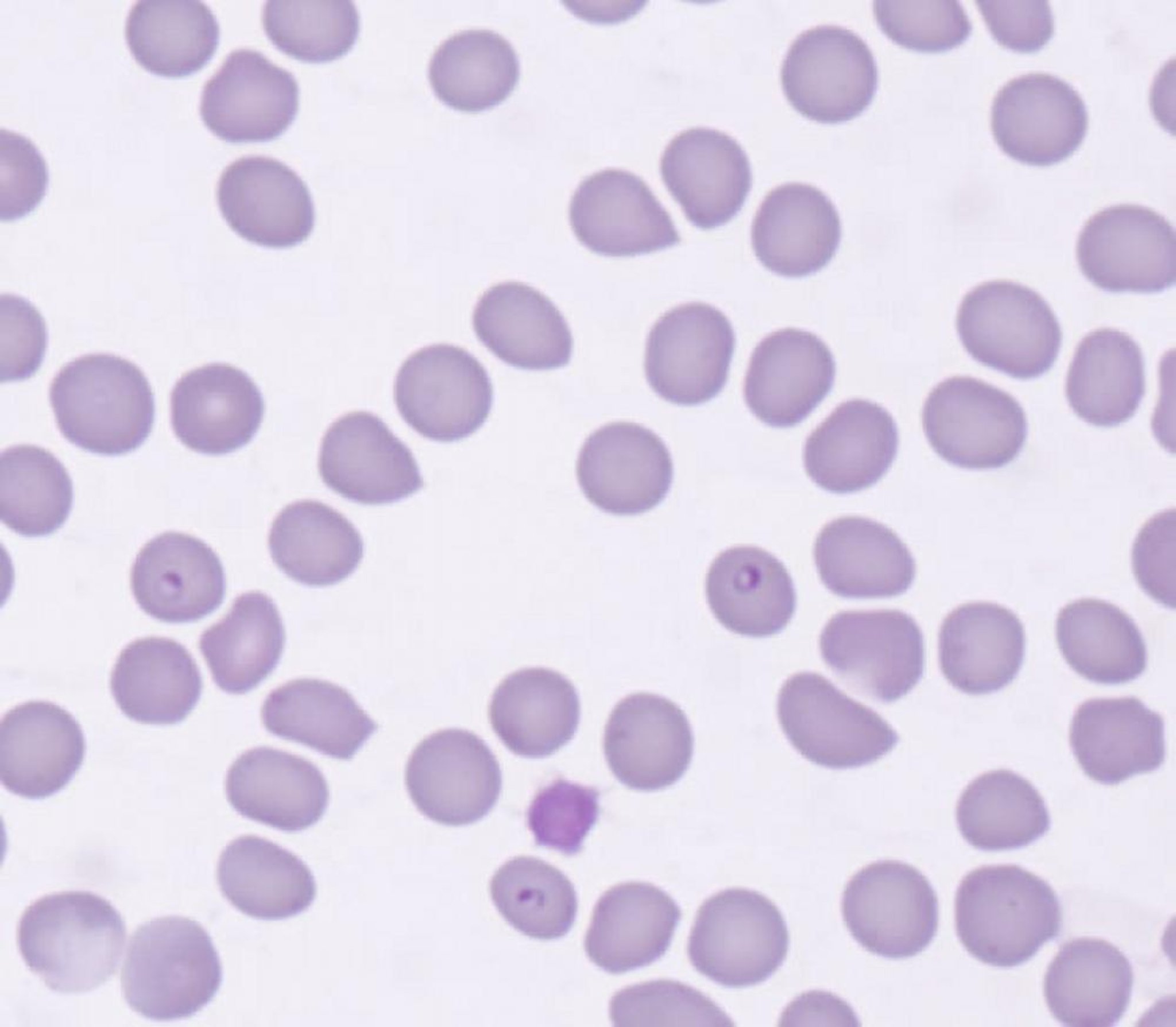 <i >Cytauxzoon felis</i> piroplasms, blood smear, cat
