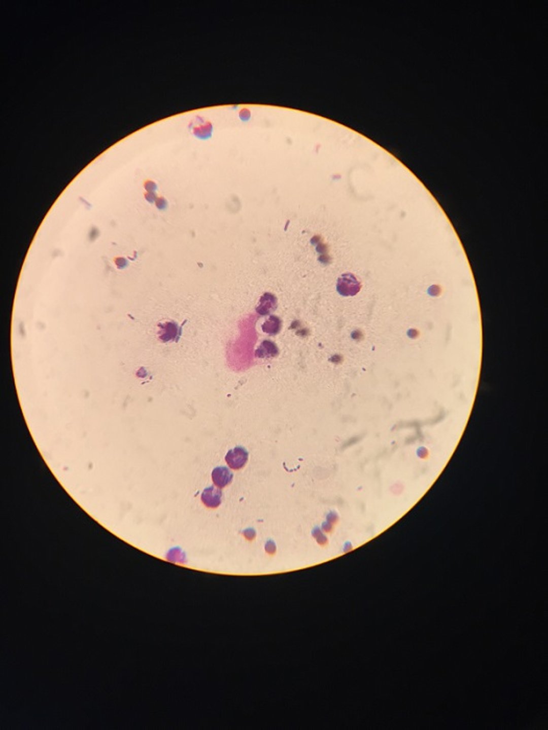 Cytologic assessment, free abdominal fluid