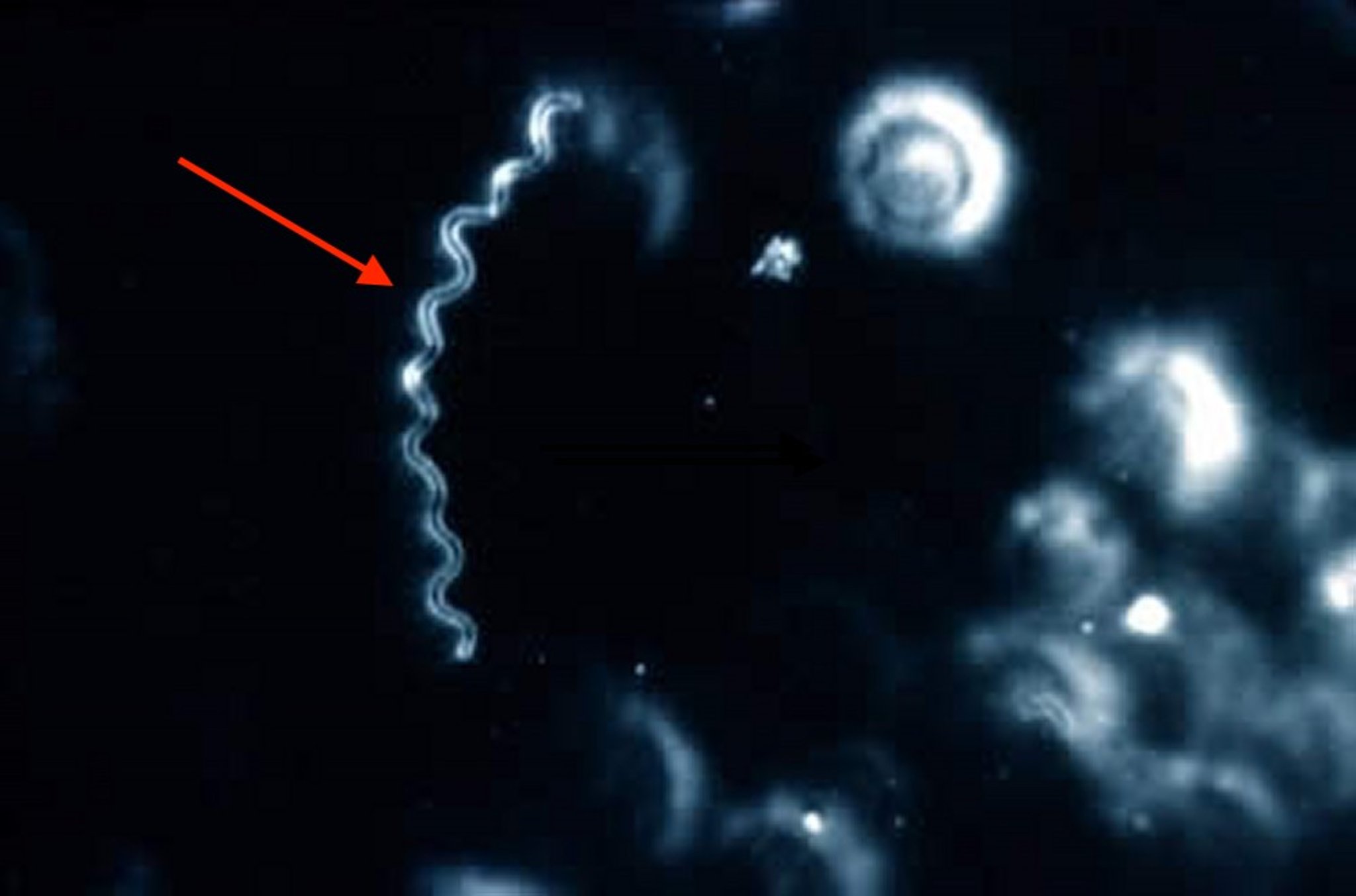 <i >Campylobacter fetus venerealis</i>