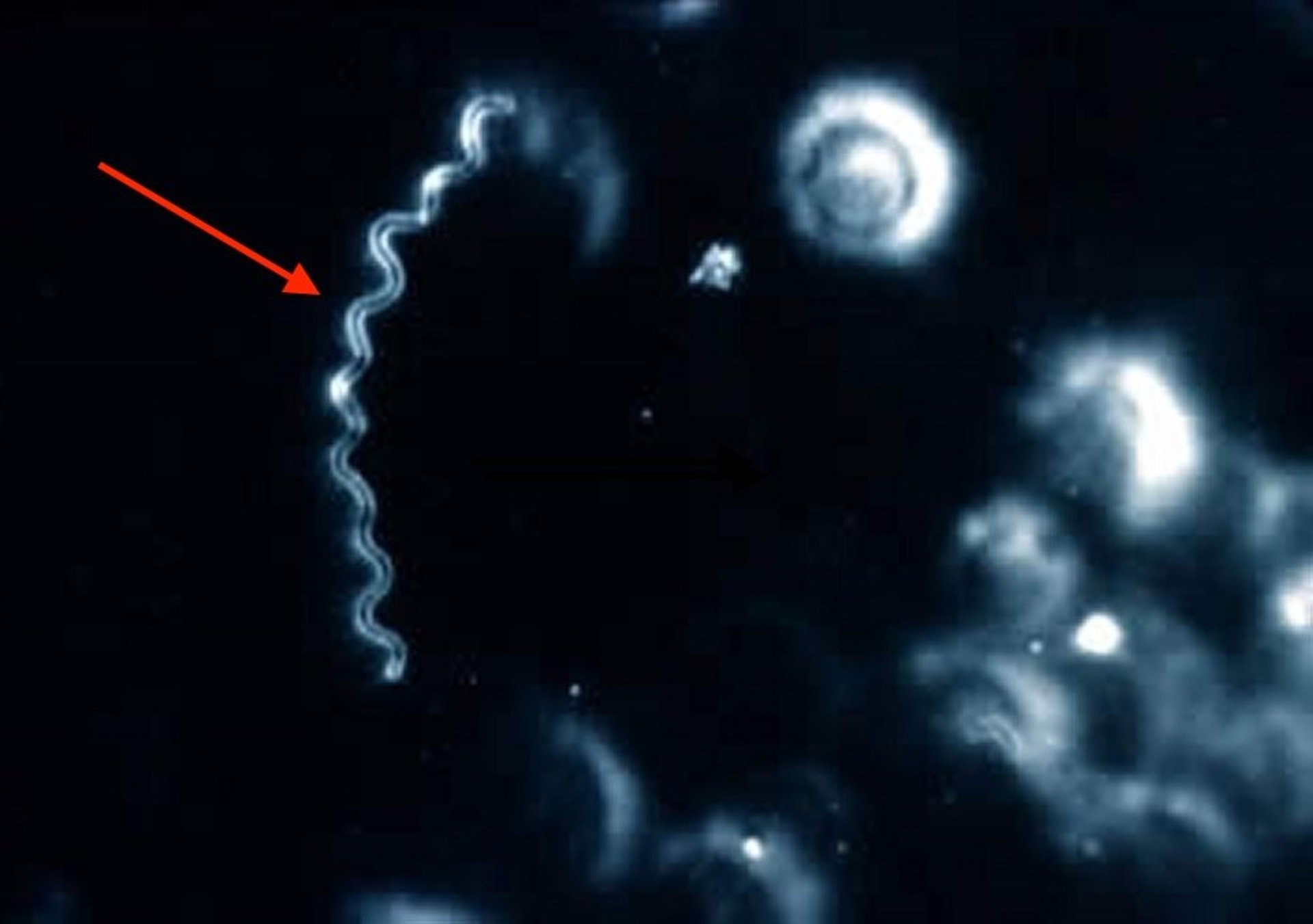 <i >Campylobacter fetus venerealis</i>, bovine abortion, photomicrograph