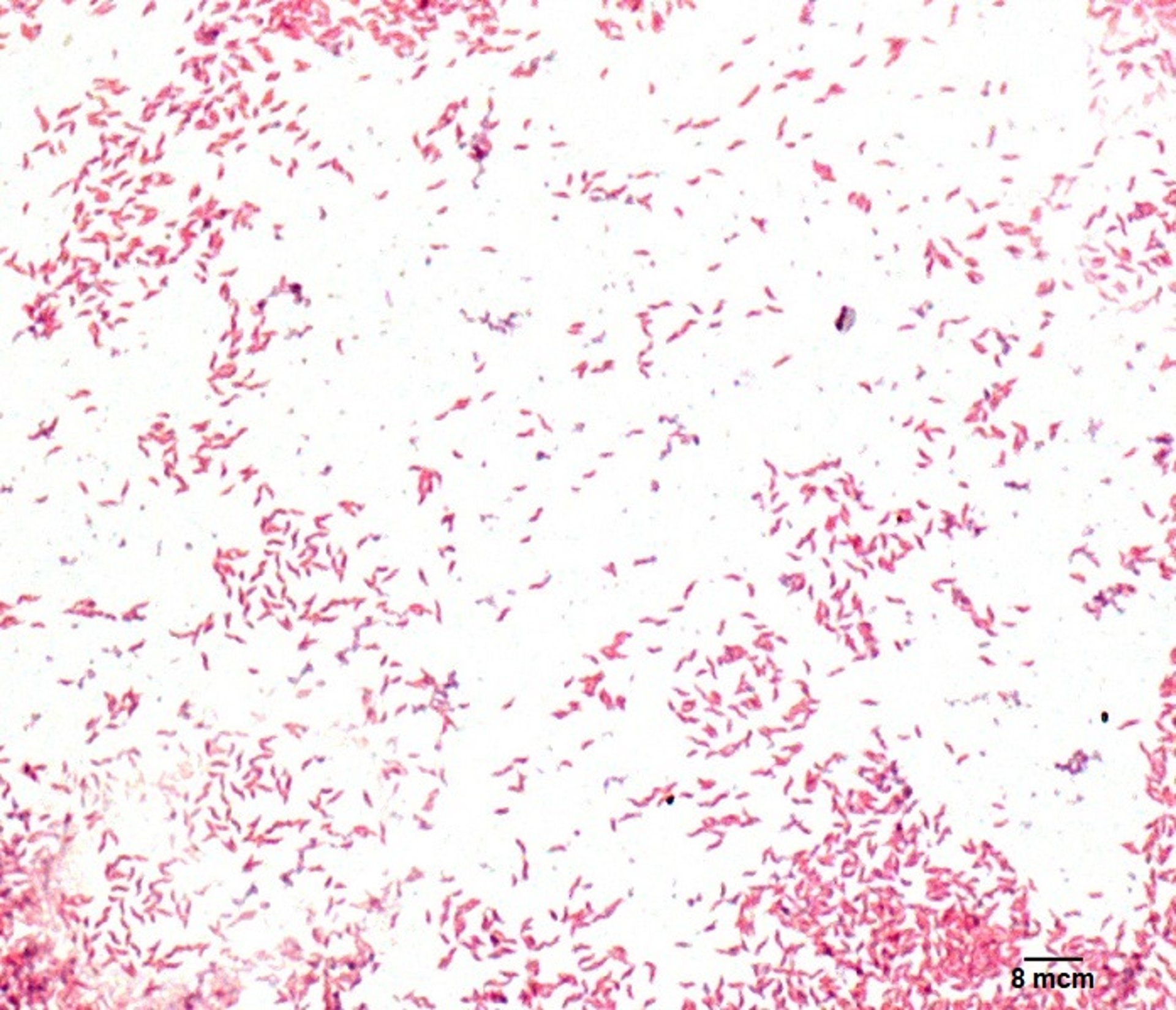 <i >Campylobacter jejuni</i>, frotis de intestino teñido con Gram, perro