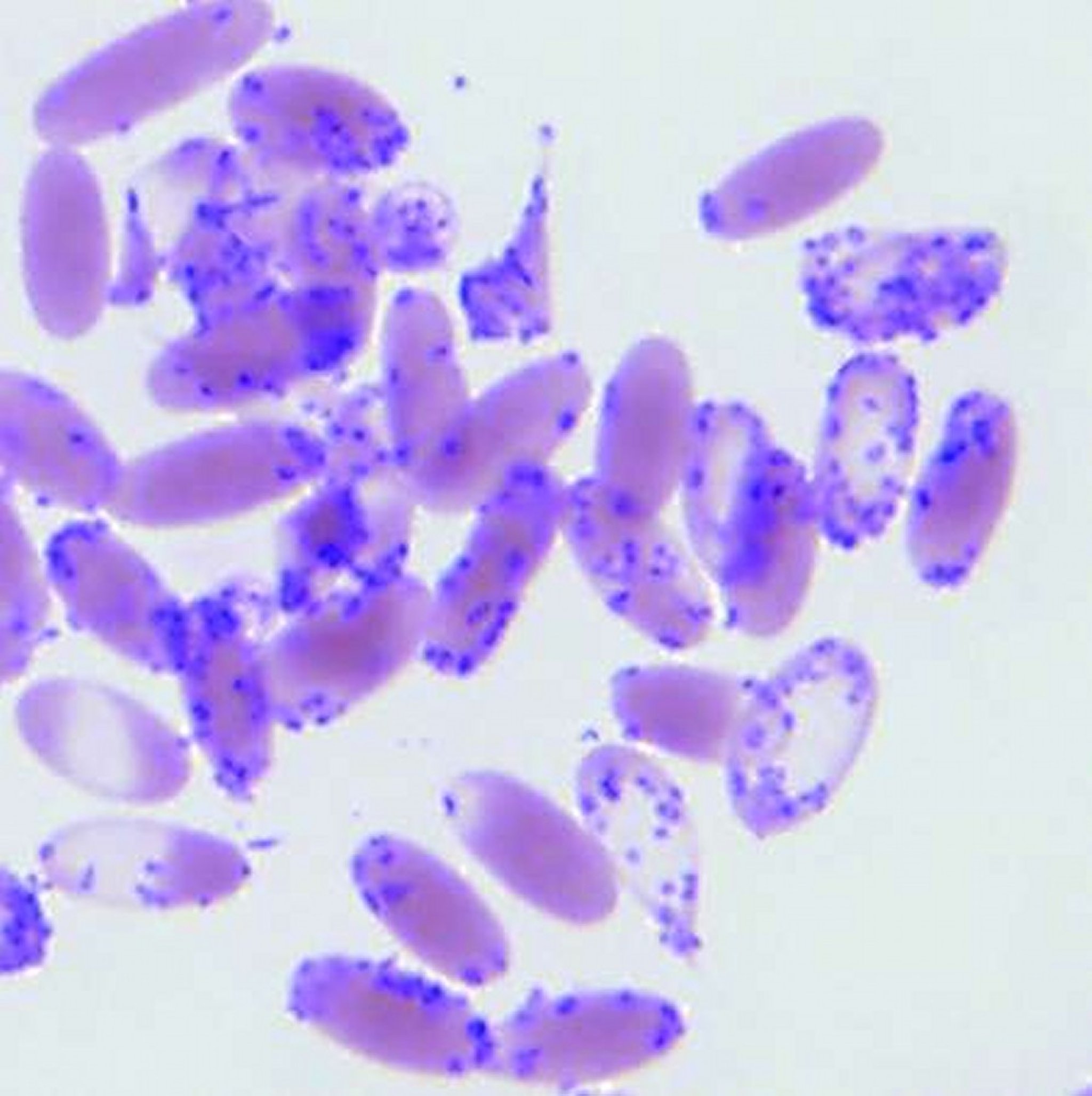 Infecção por “<i >Candidatus Mycoplasma haemolamae</i>”, esfregaço de sangue, cria