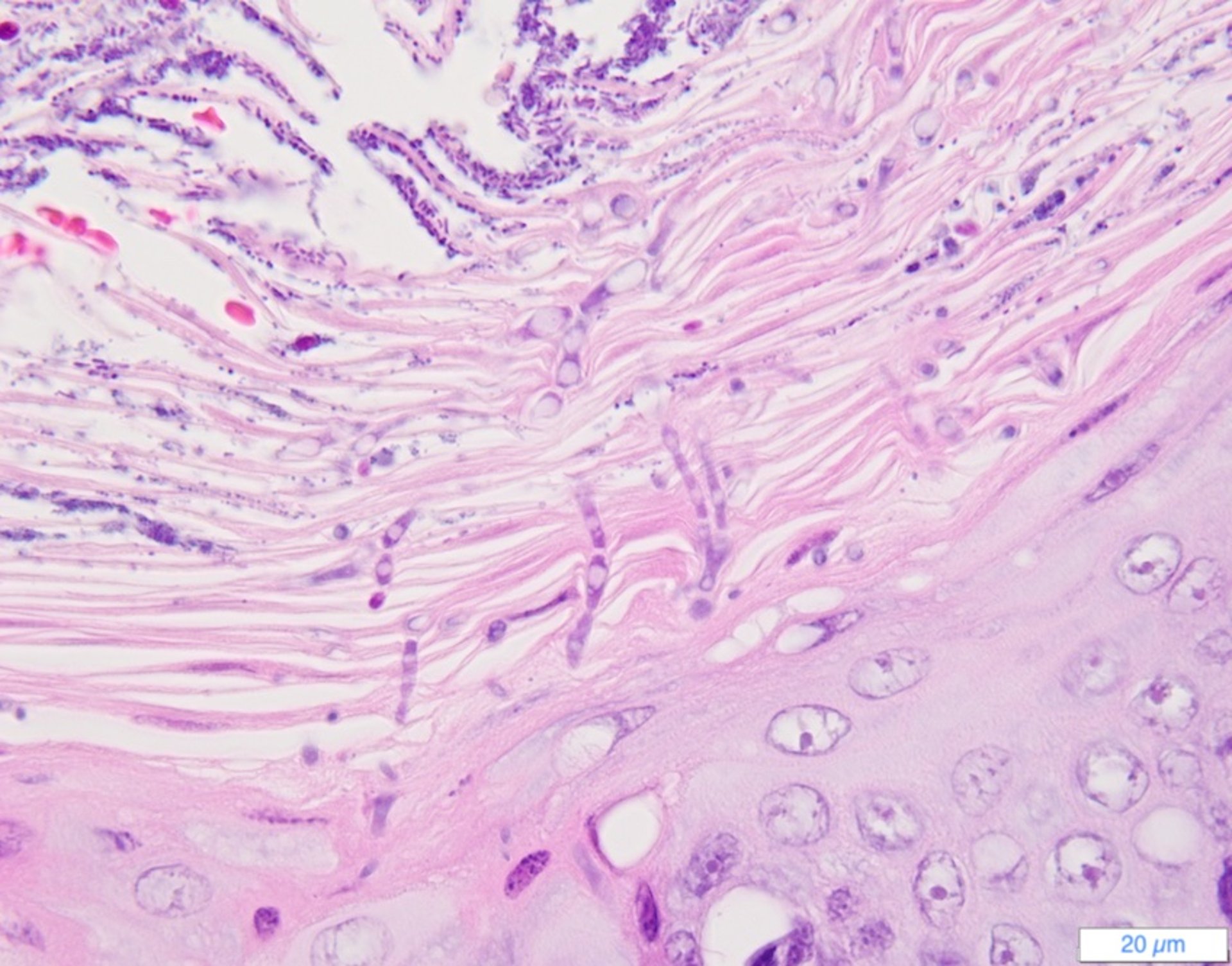 Candidiasis esofágica, gato