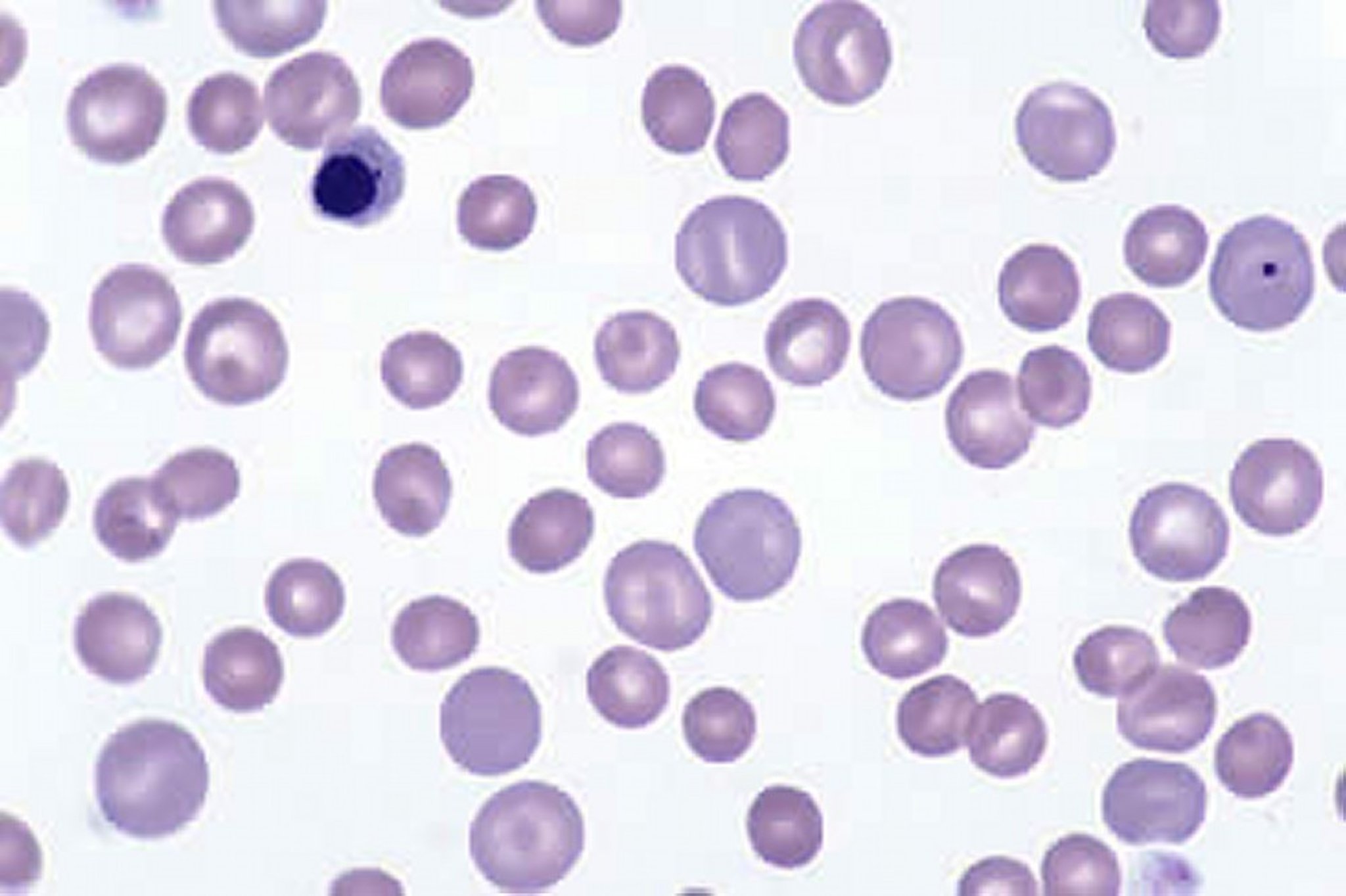 Frotis de sangre canina, anemia marcadamente regenerativa