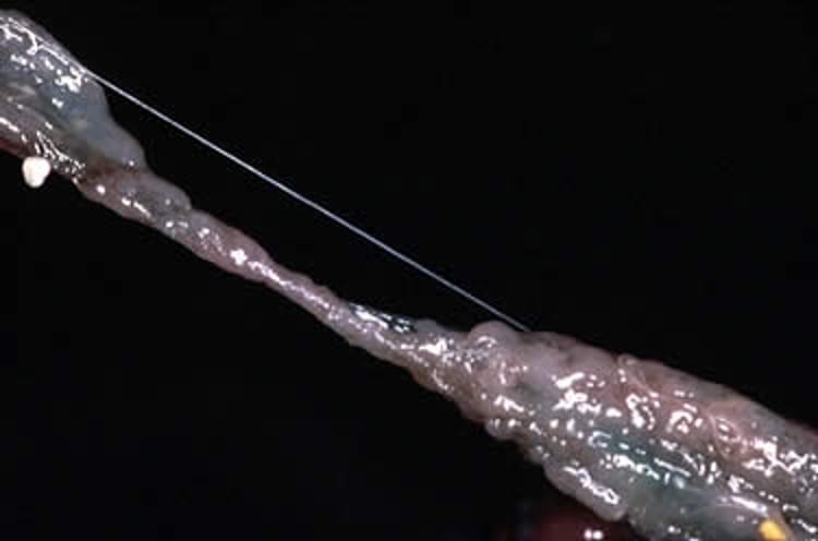 <i >Capillaria contorta</i>, cultivo, codorniz