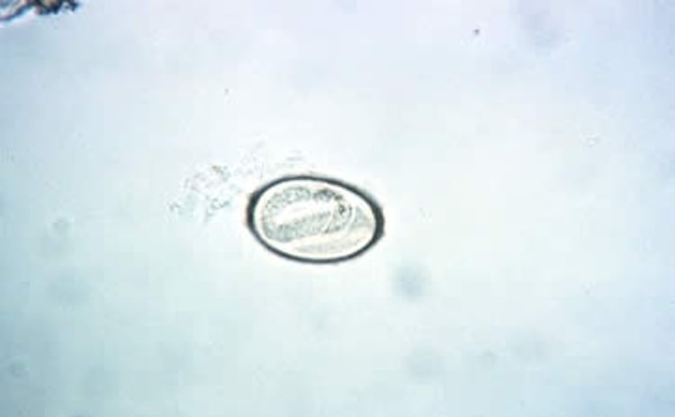 Huevo de <i >Capillaria</i>