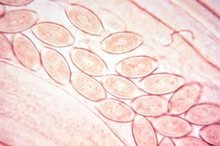 <i >Capillaria</i> eggs in gravid worm, poultry
