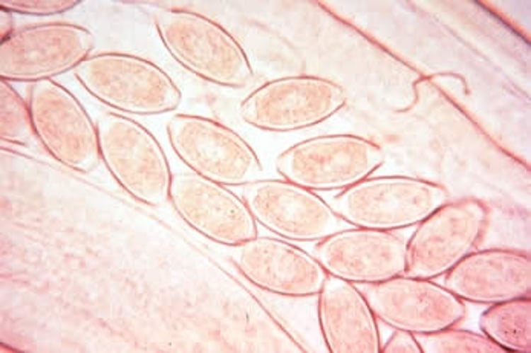 Huevos de <i >Capillaria</i> en un gusano grávido