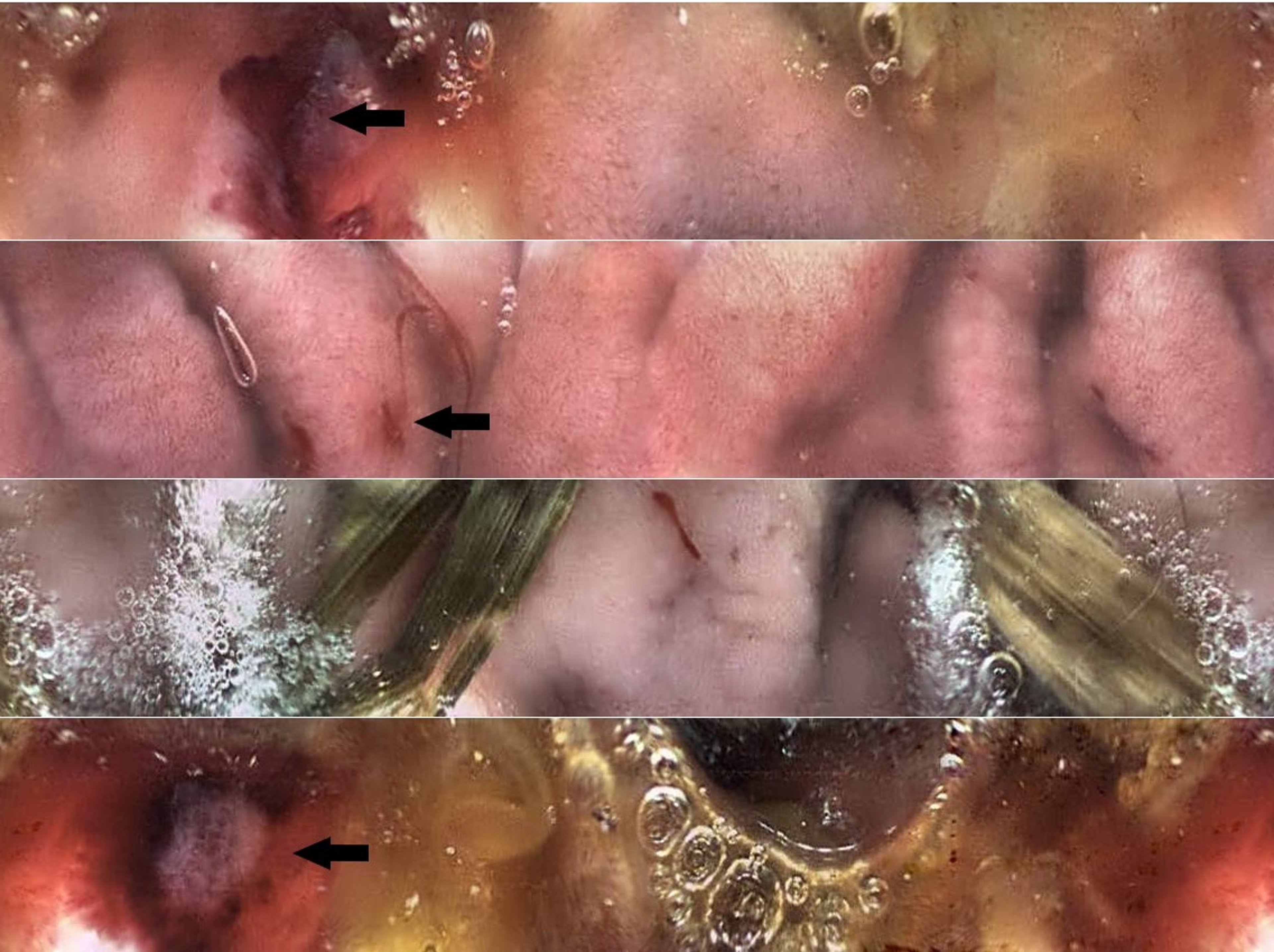Úlcera duodenal, endoscopia capsular, cão