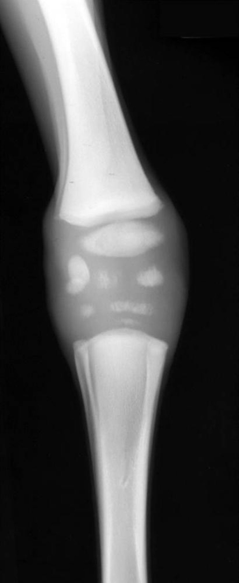 Cuboidal bone hypoplasia, radiograph, foal