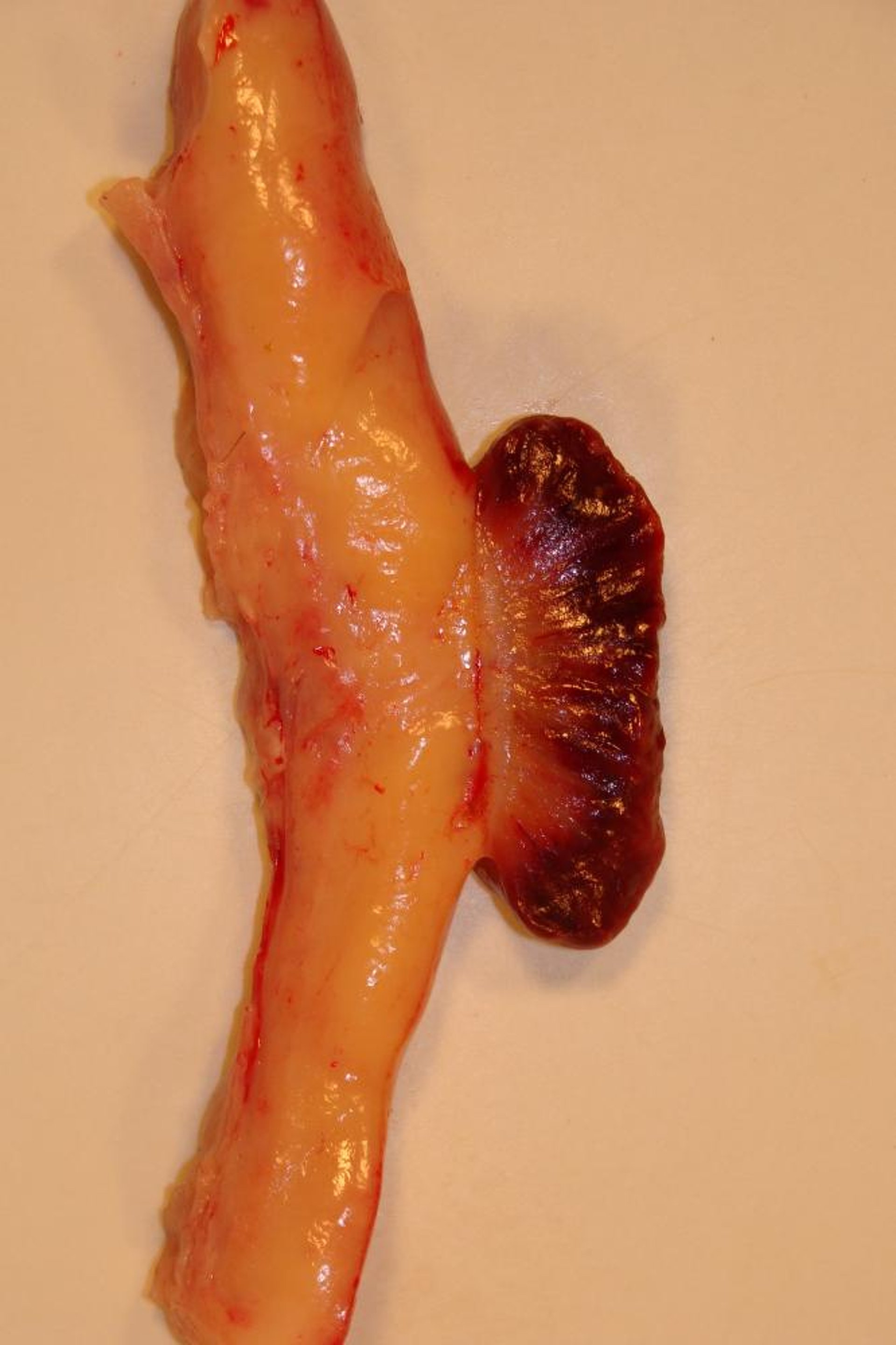 Uterine wall and caruncle, cow