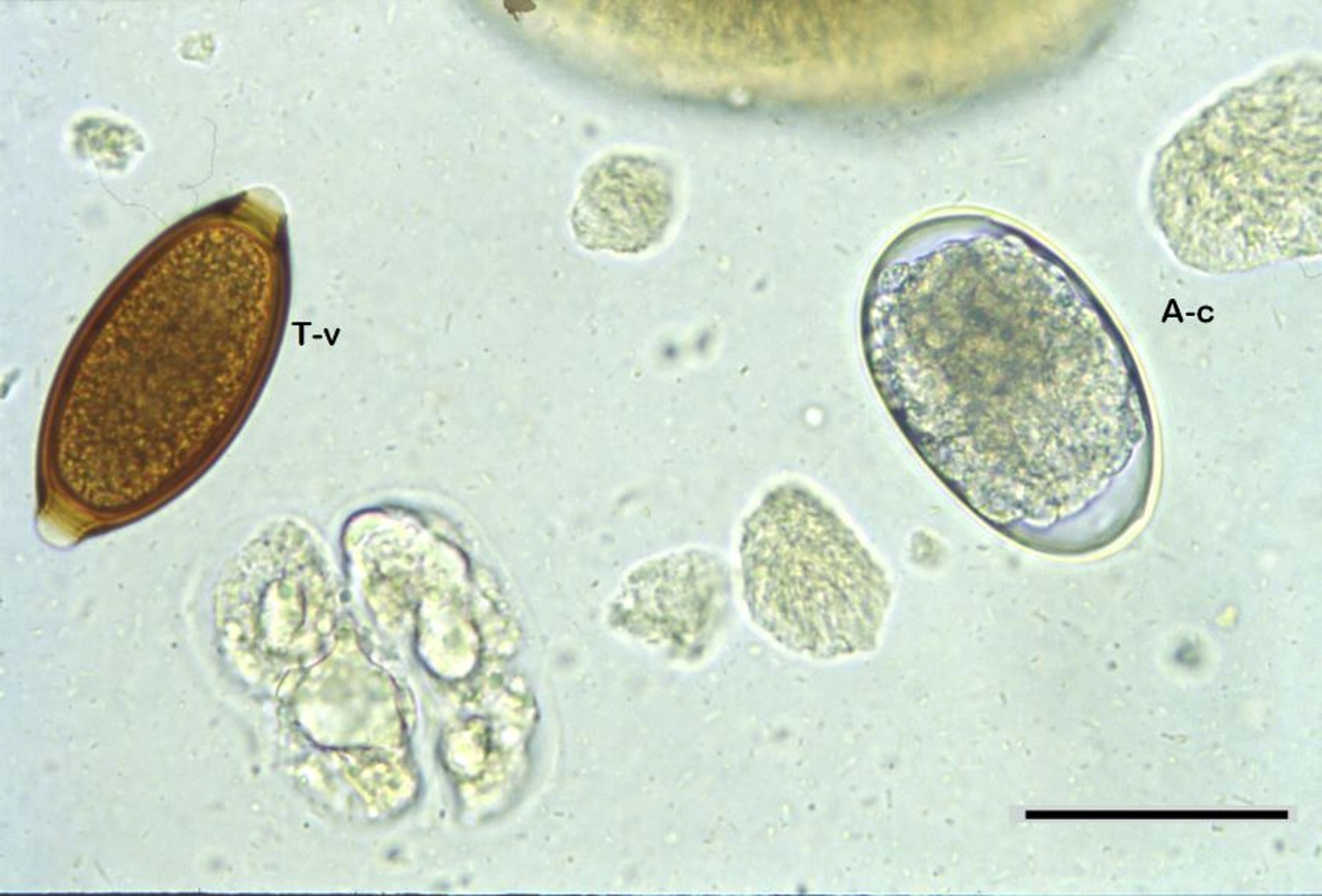Centrifugal fecal flotation sample, dog