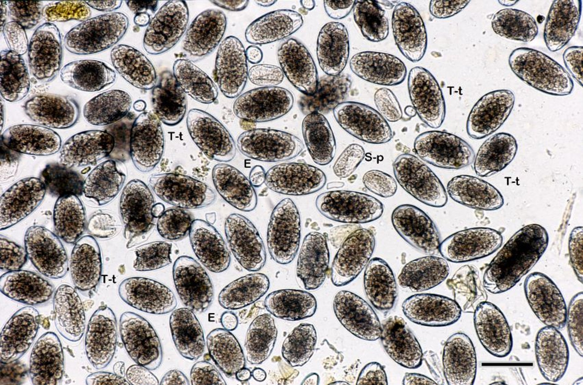 Centrifugal fecal flotation sample, sheep