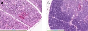 Infección por el virus de la anemia del pollo, timo