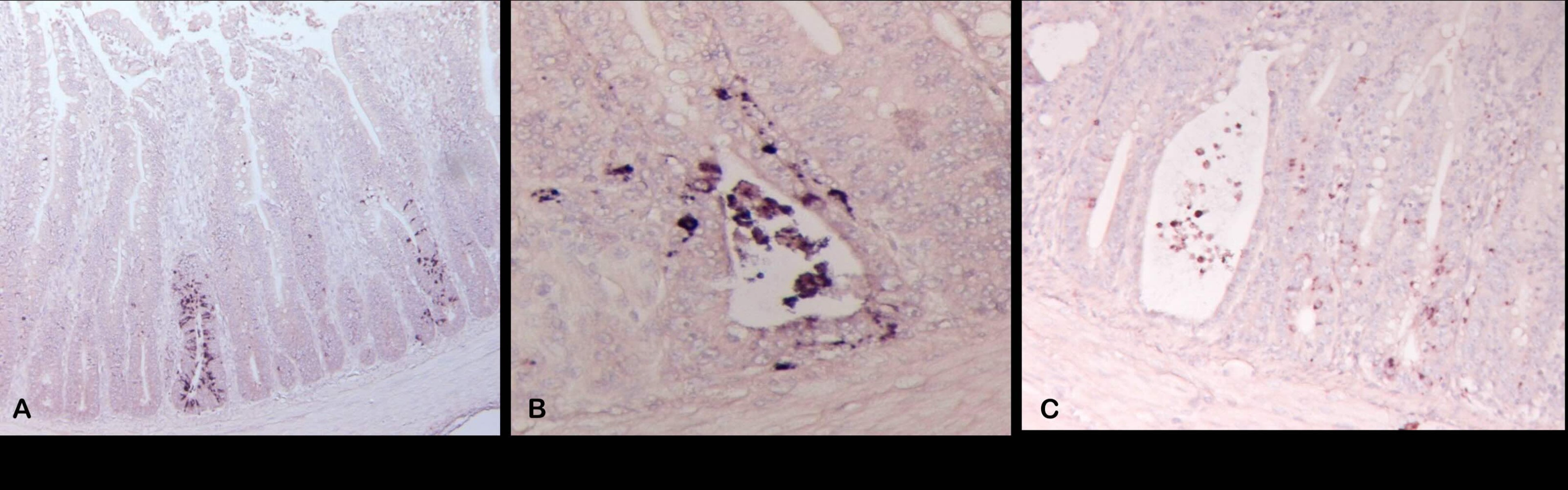 Astrovirus de pollo, duodeno, polluelo