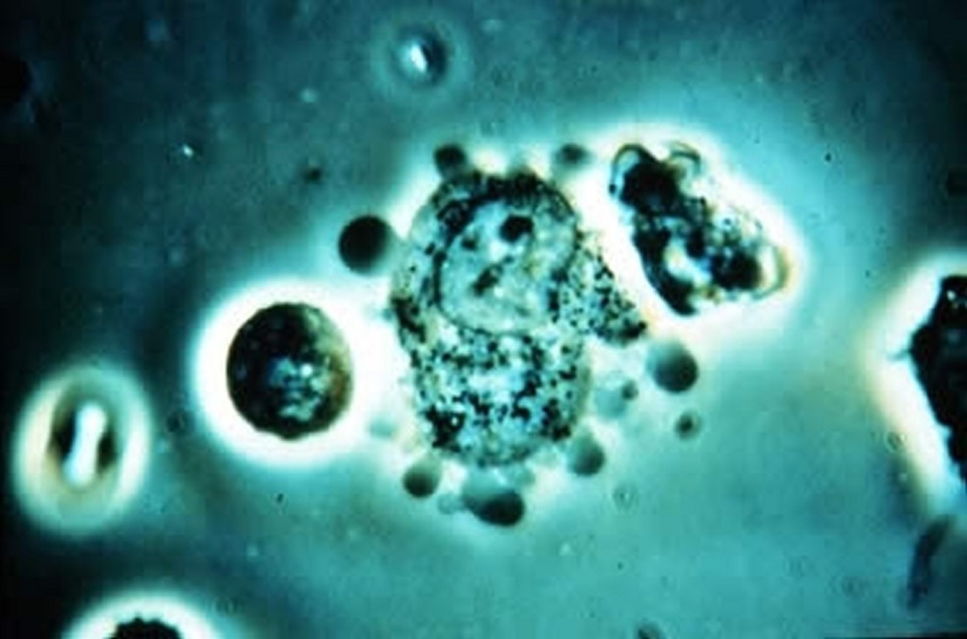 <i >Chlamydia psittaci</i>, elementary bodies