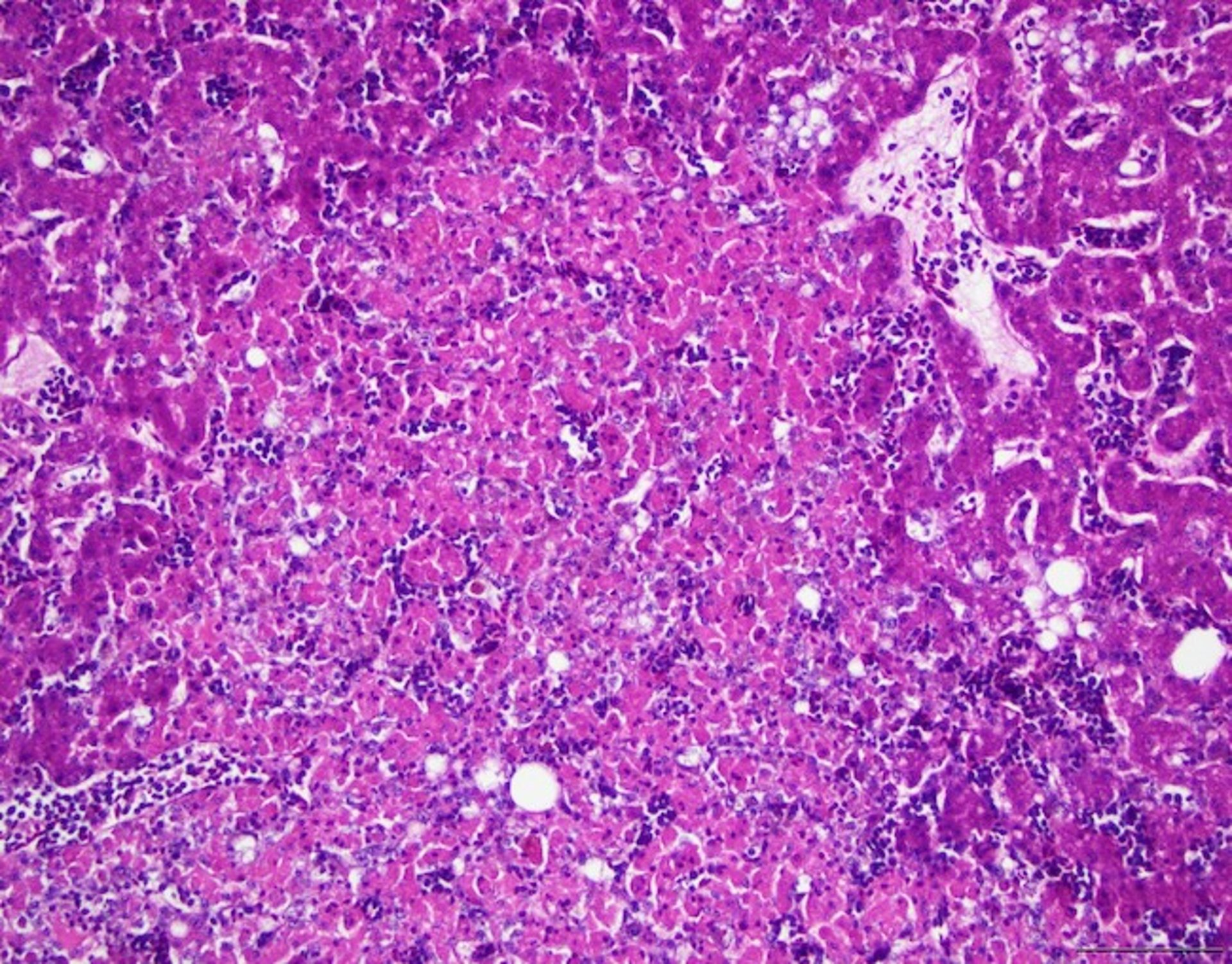 Clamidiosis, hígado, cacatúa