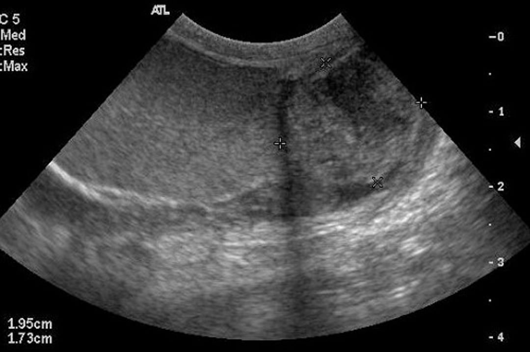 Epididimitis crónica, epidídimo agrandado, ecografía, perro