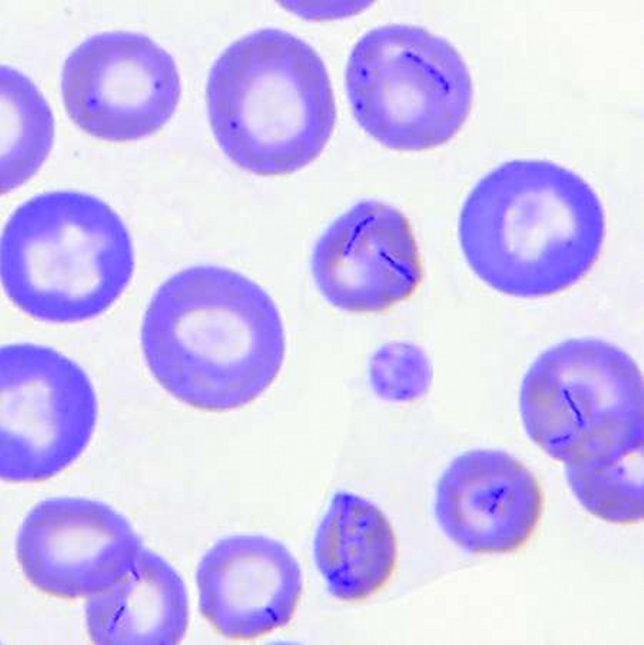 Infecção por <i >Mycoplasma haemocanis</i>, esfregaço de sangue canino