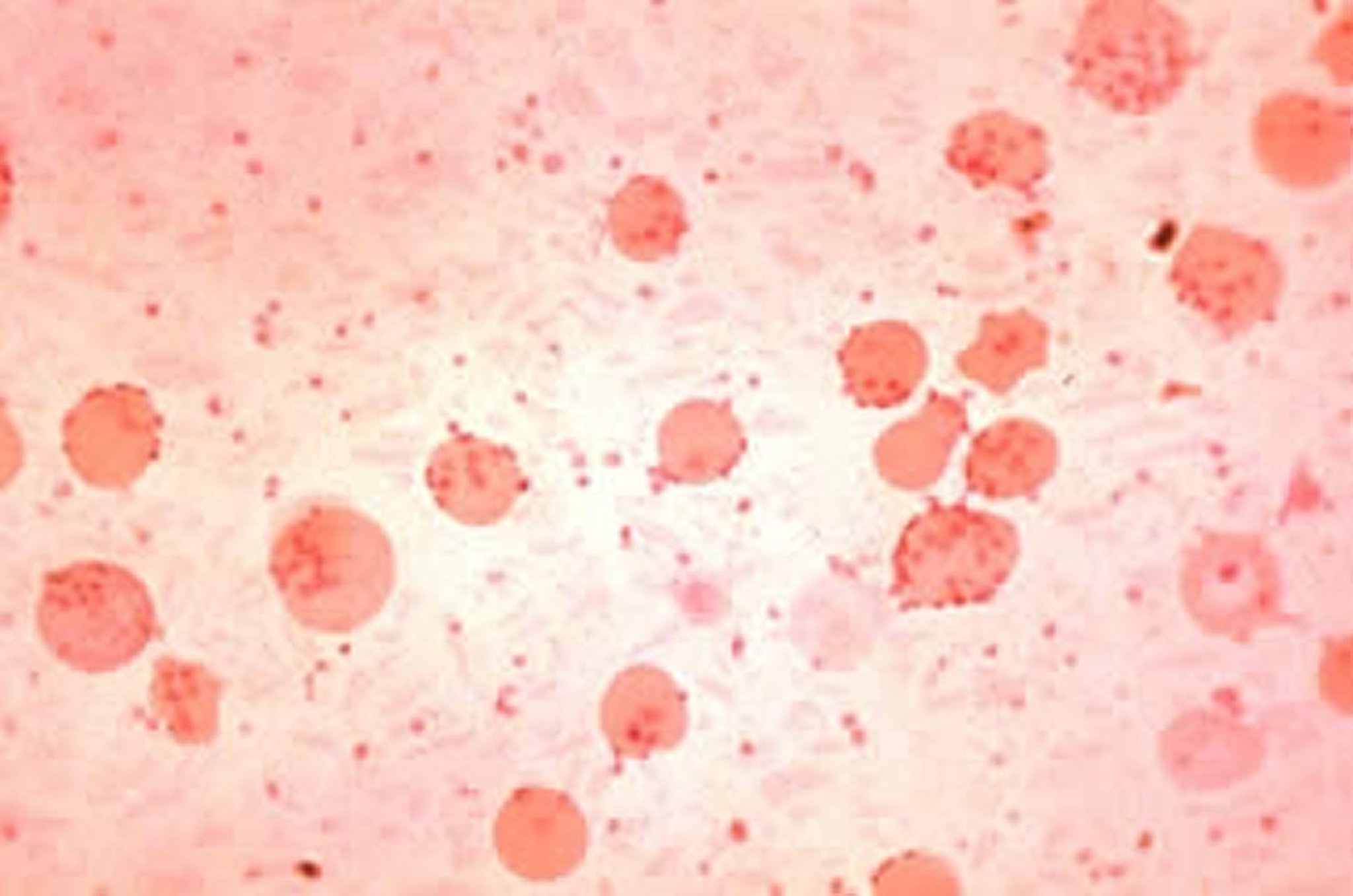 <i >Mycoplasma (Eperythrozoon) suis</i>, esfregaço de sangue de porco