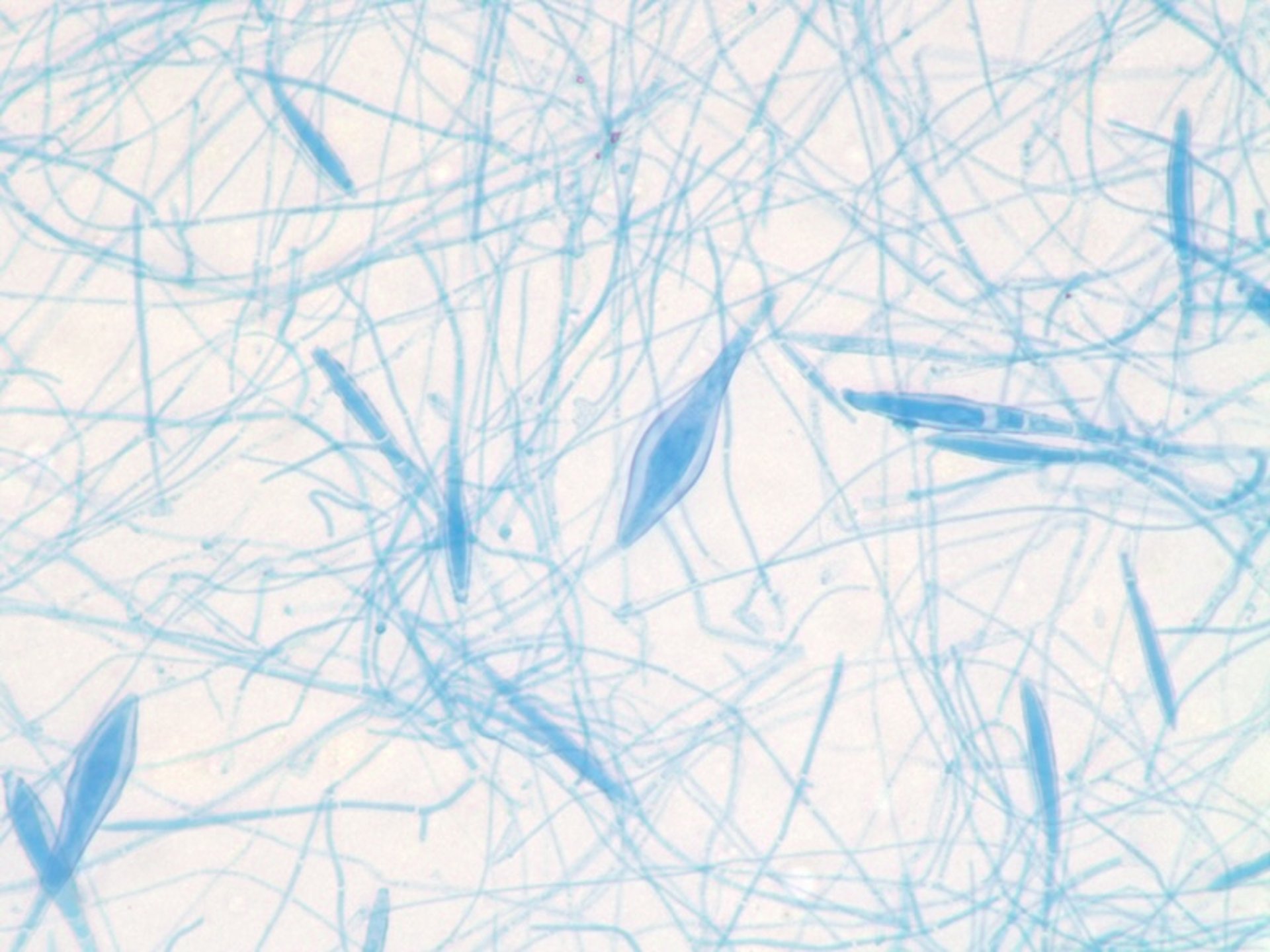 Aspecto microscópico clásico, <i >Microsporum canis</i>