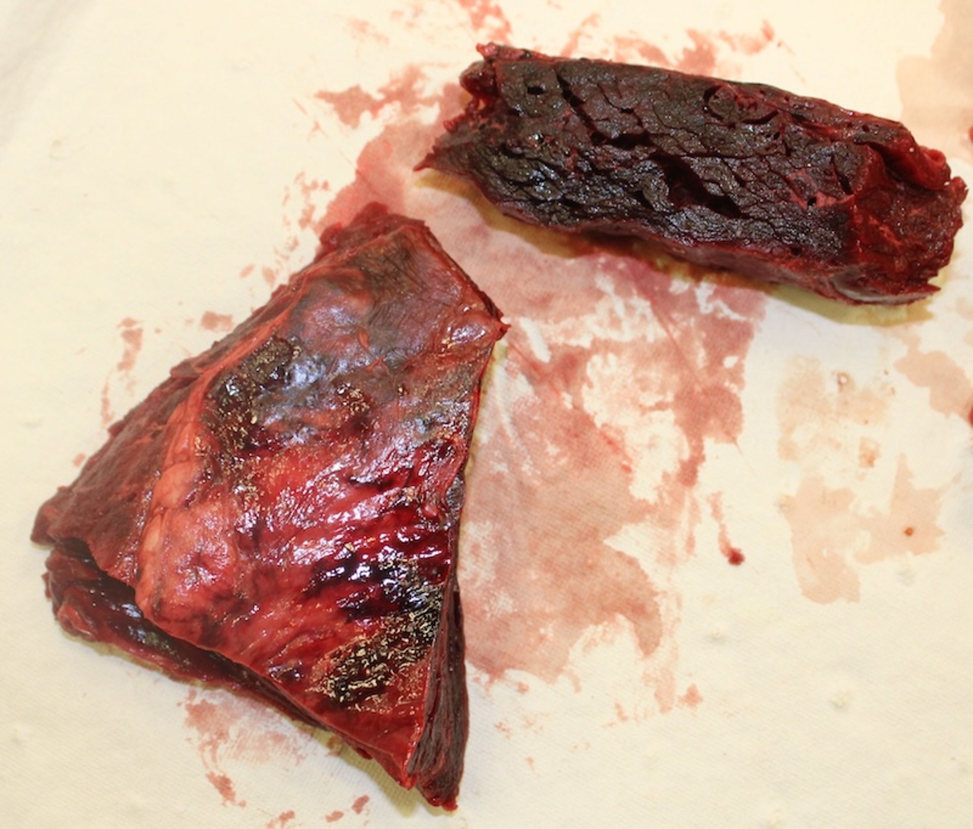 Clostridial myonecrosis, heifer, necropsy image