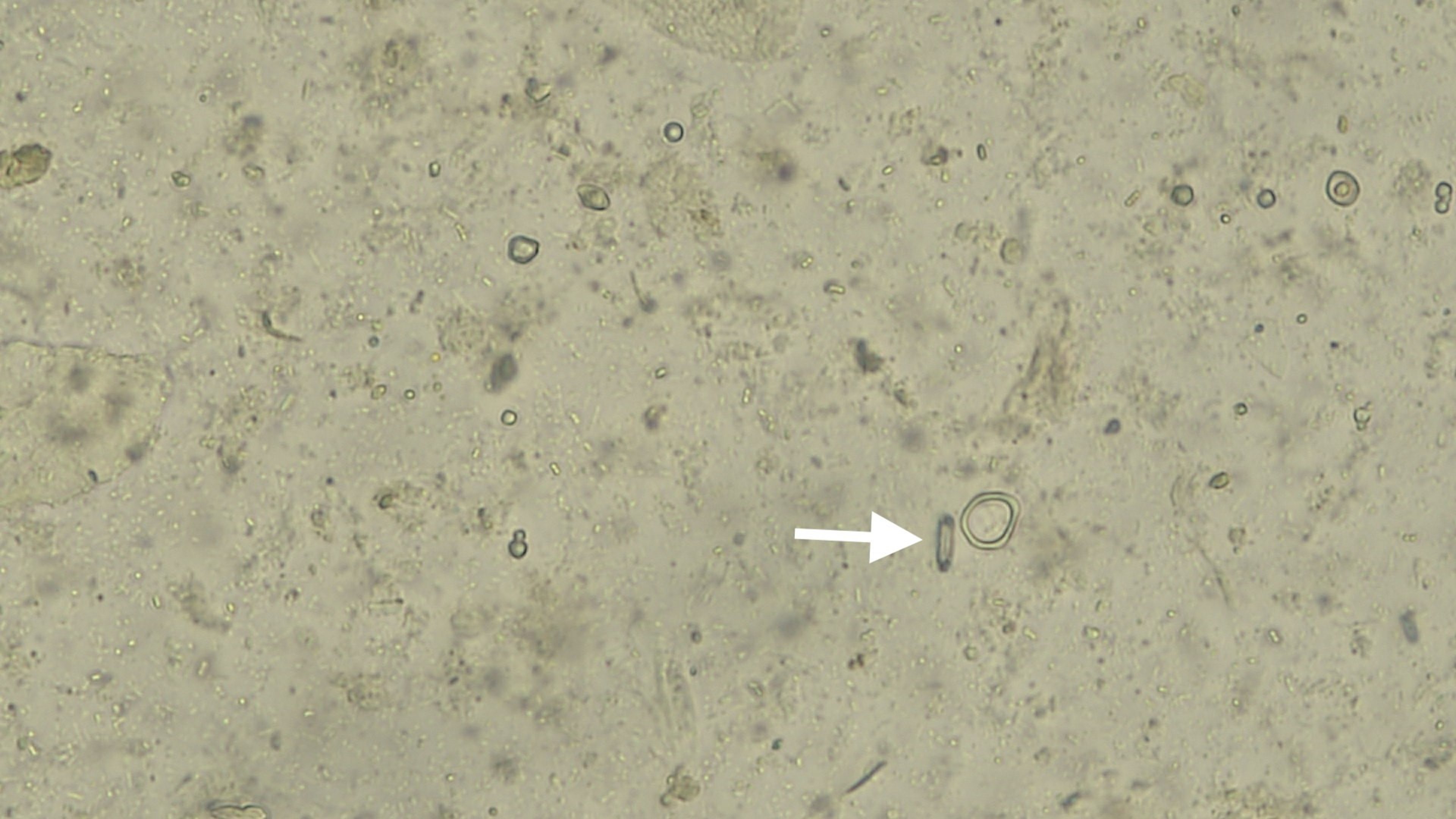 <i >Clostridium</i>, frotis fecal de conejo