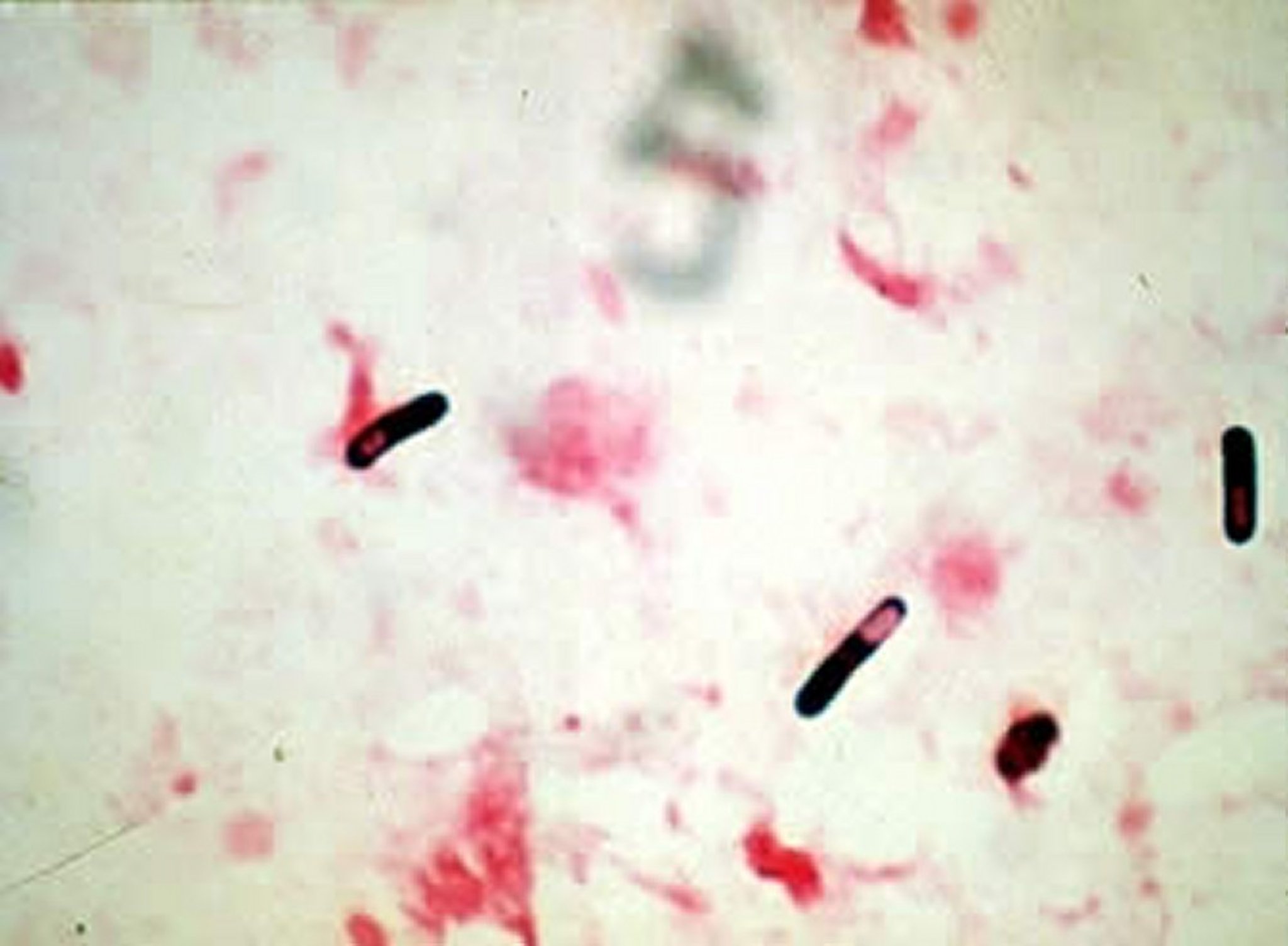 <i >Clostridium</i> spp, tinción de Gram