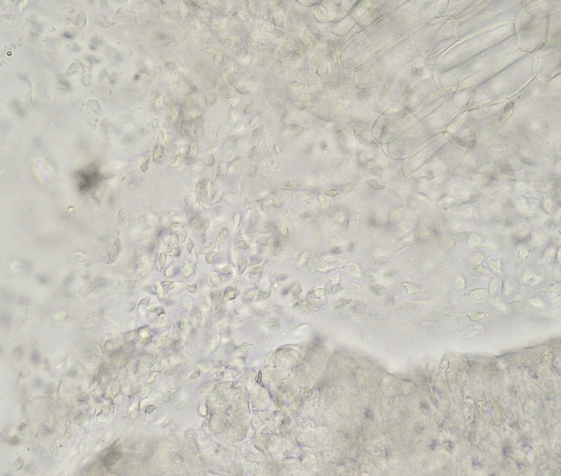 <i >Cochlosoma</i> parasites, turkey