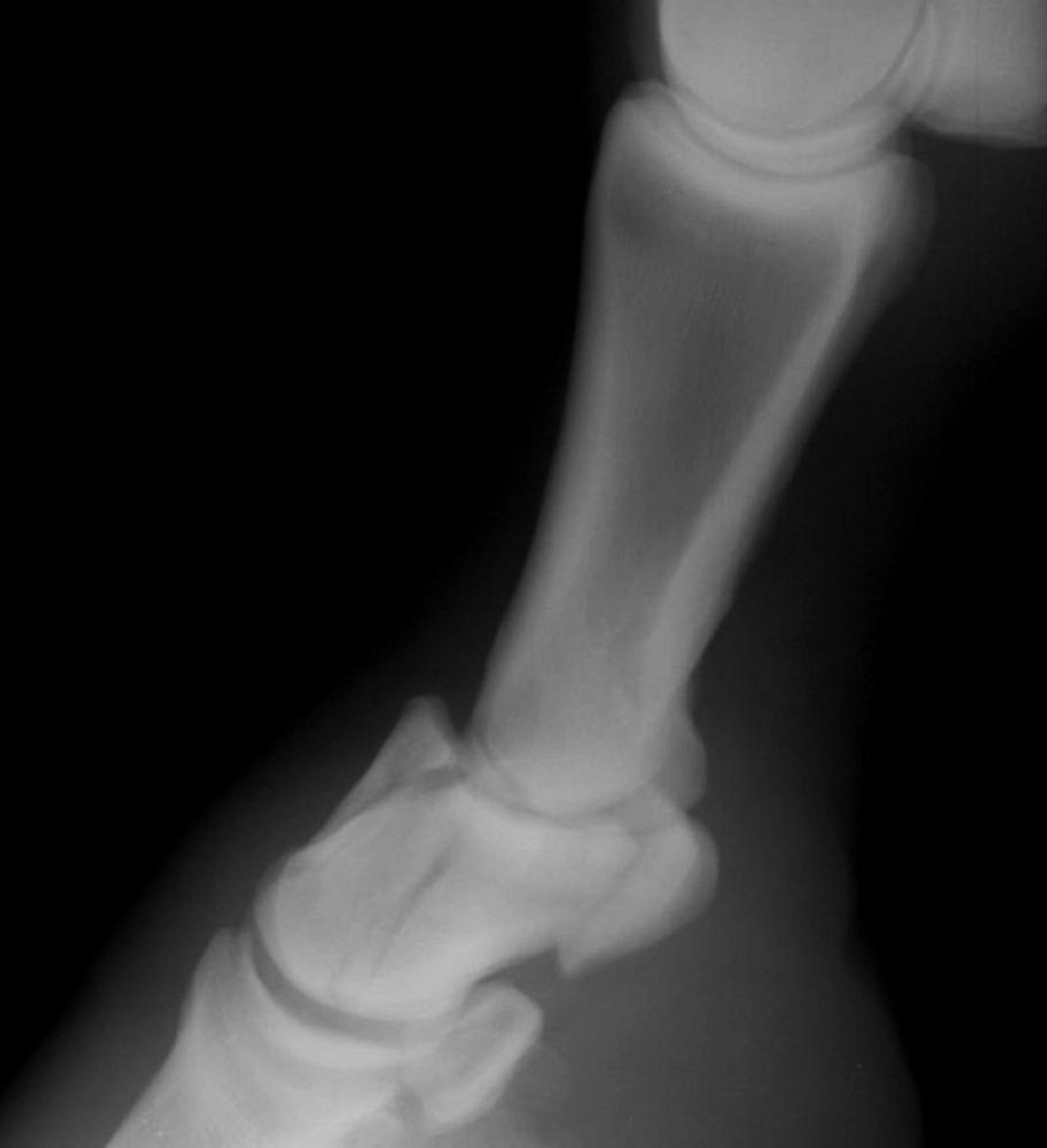 Fractura conminuta de la segunda falange, caballo