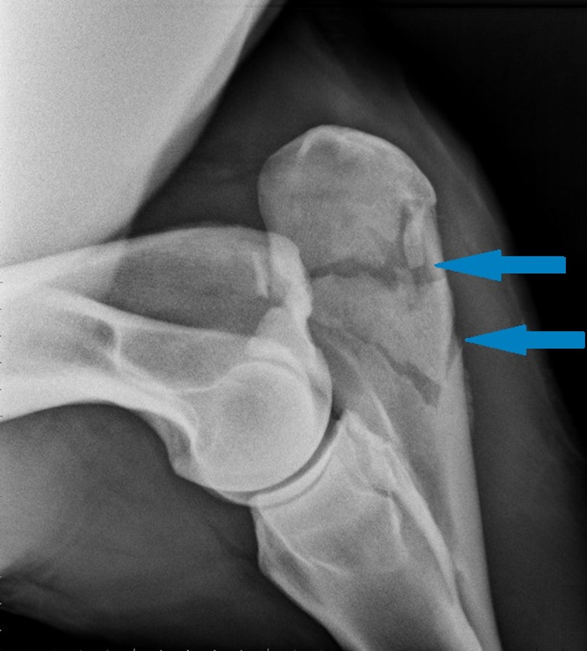 Fractura cubital, radiografía, caballo