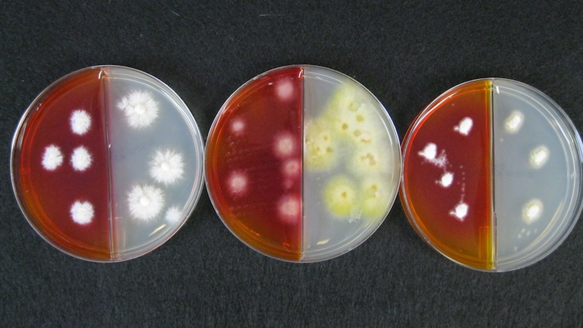 Comparison of gross colony morphology, common pathogens