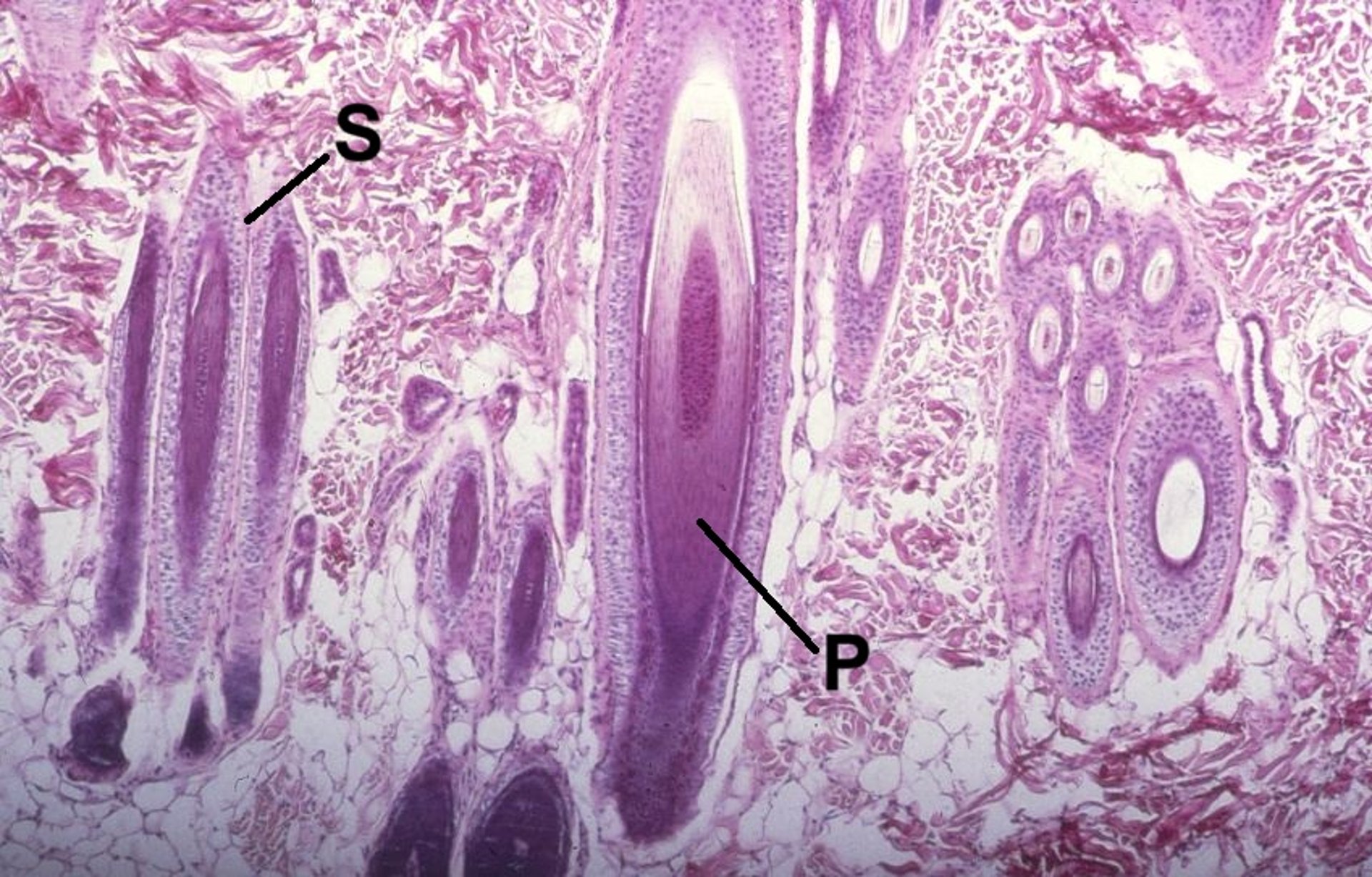 Compound hair follicle, photomicrograph, dog