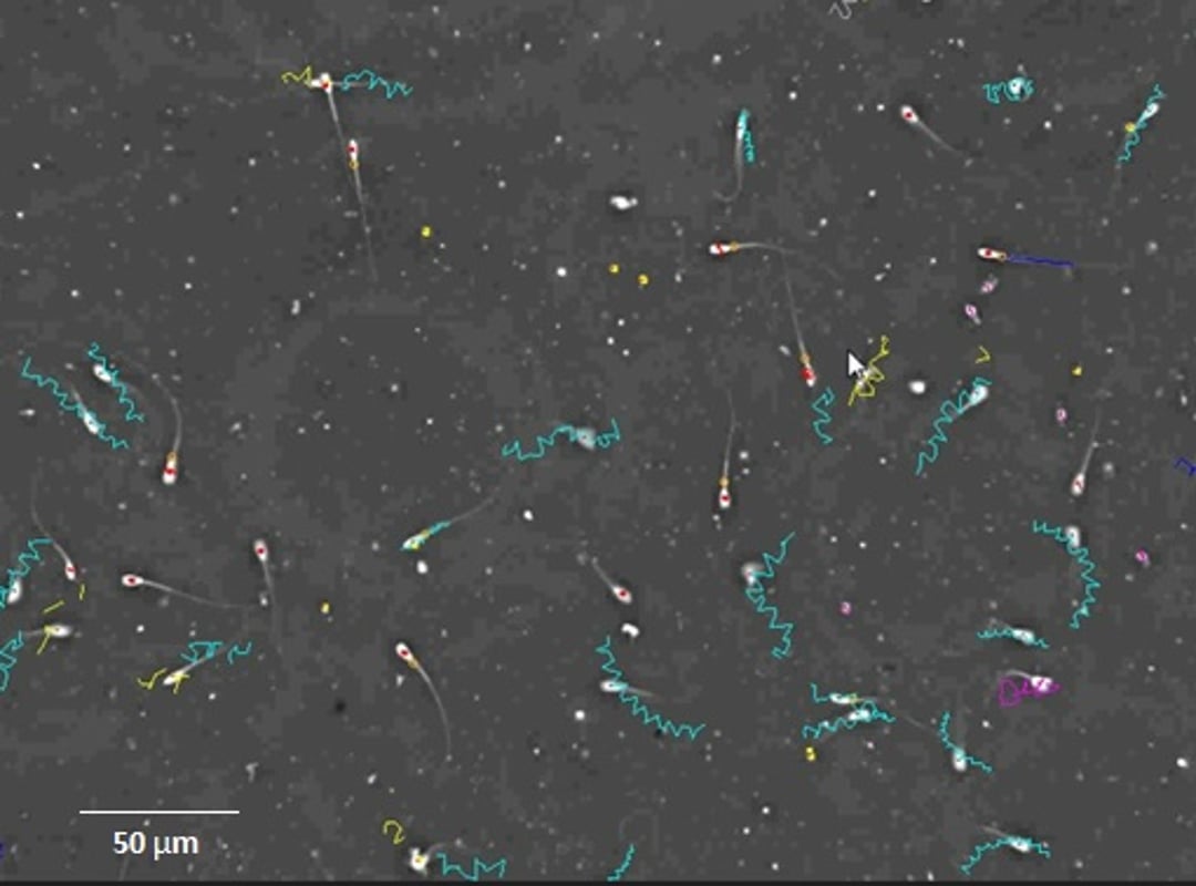 Análisis de semen asistido por computadora, buena muestra