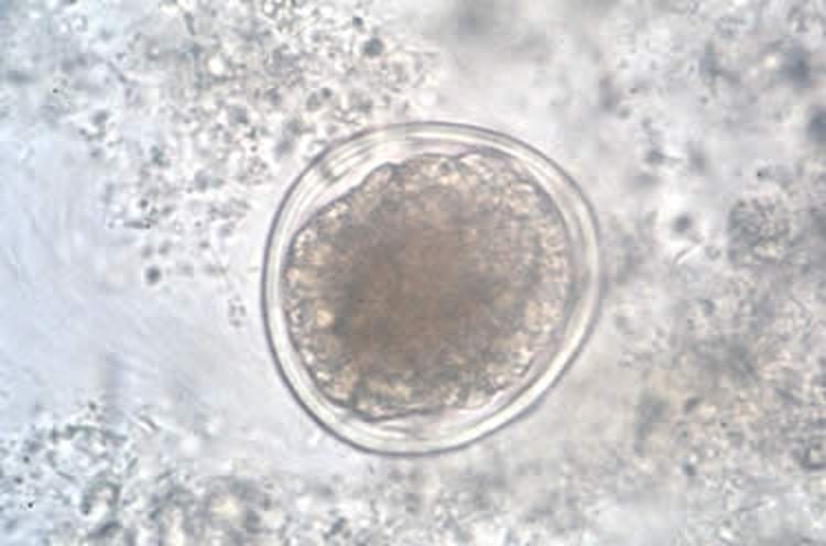 <i >Contracaecum</i> spp, huevo embrionado