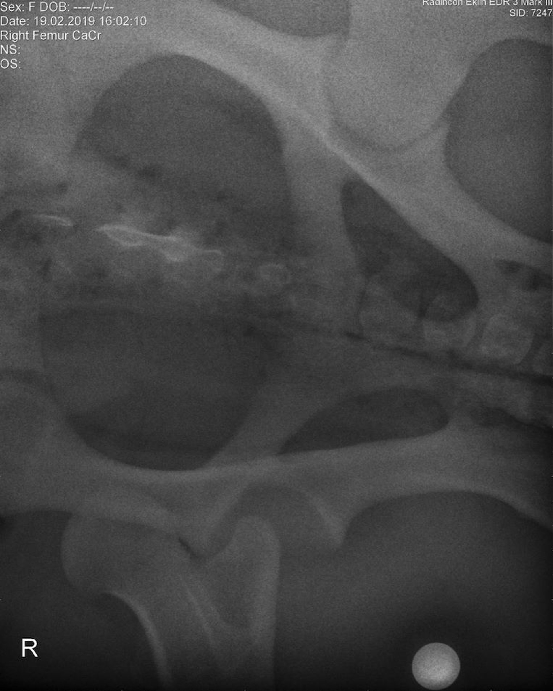 Luxación de la articulación coxofemoral, radiografía preoperatoria ventrodorsal, poni