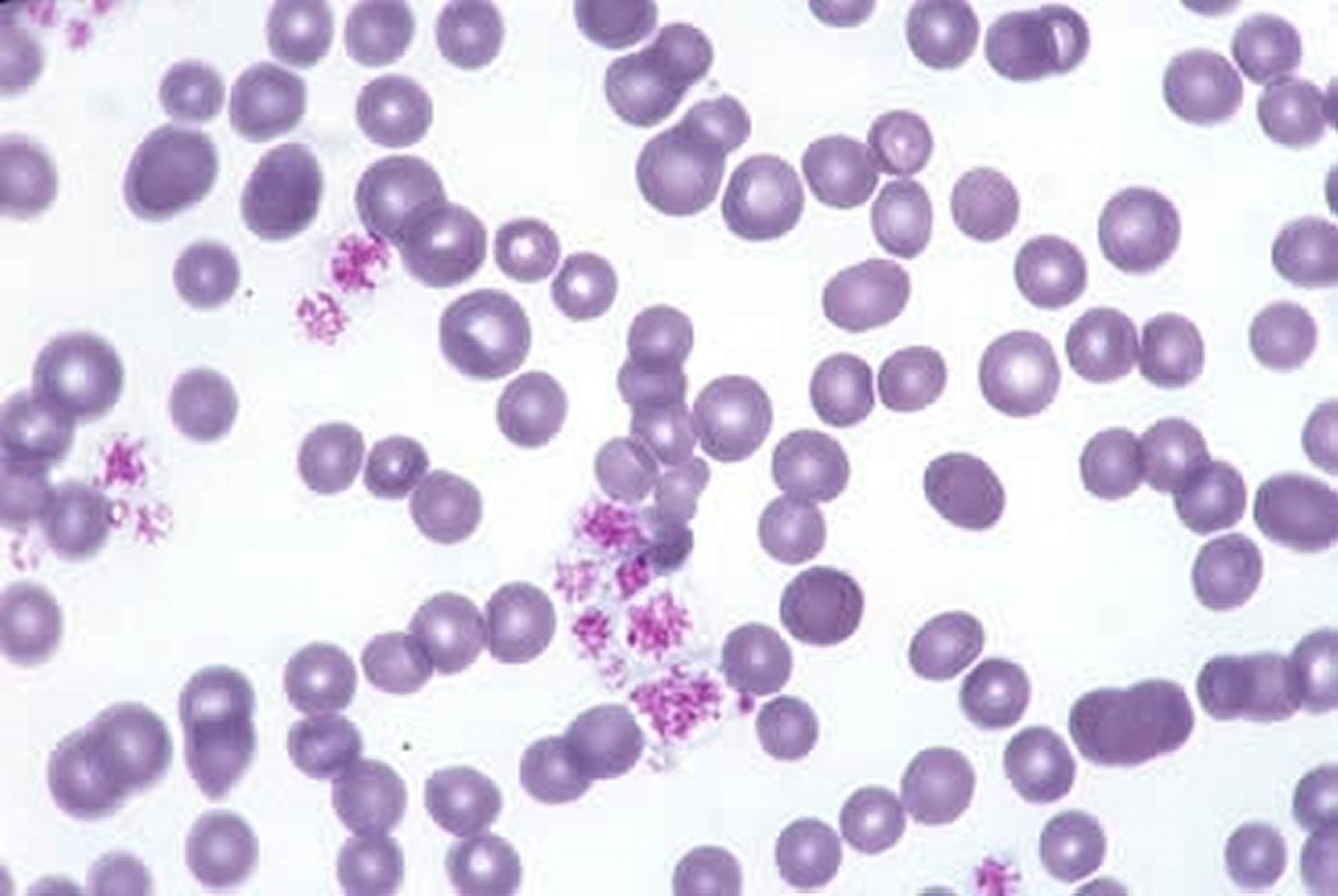 Anemia no regenerativa, frotis sanguíneo, gato