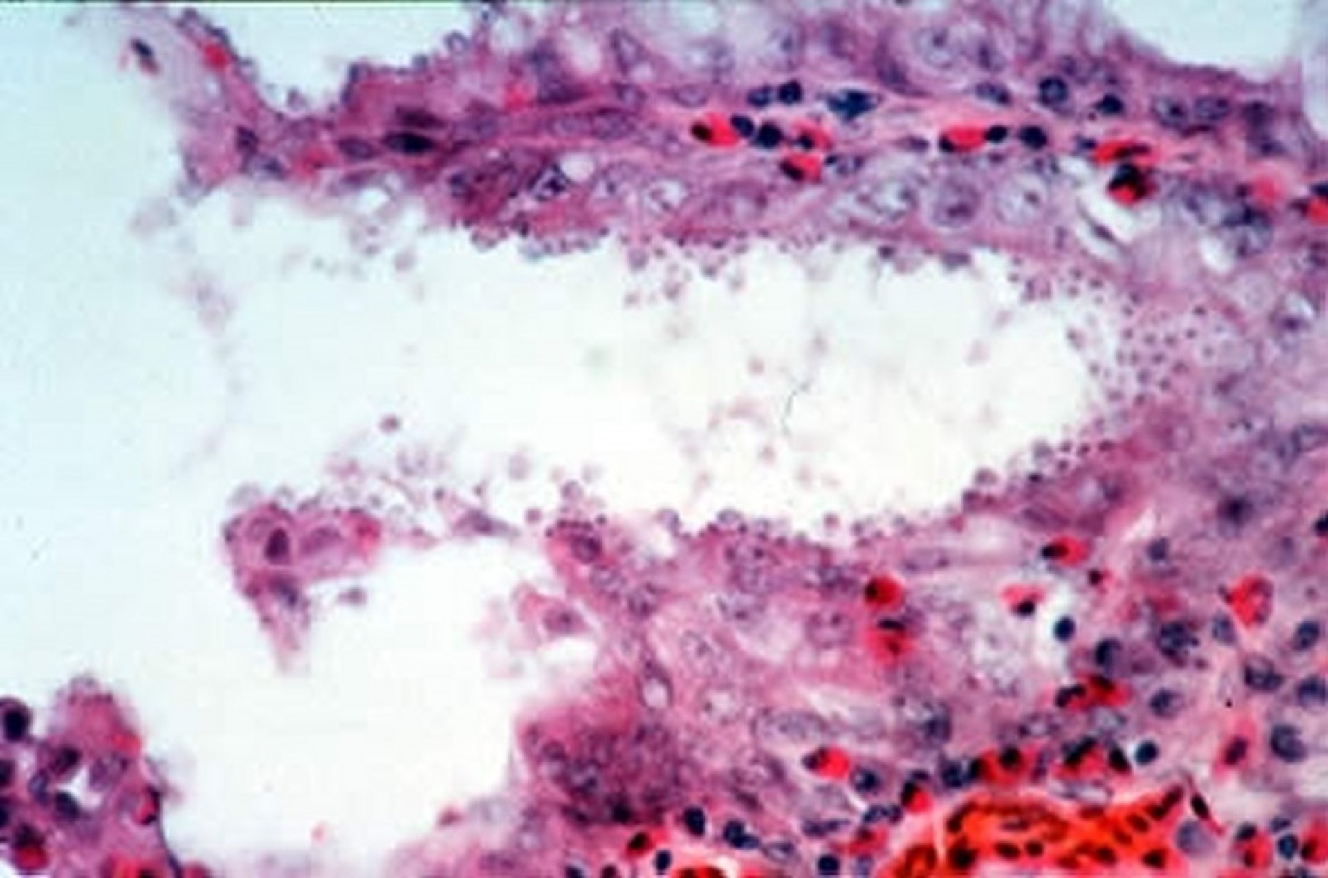 <i >Cryptosporidium</i>, tracheal mucosa, turkey