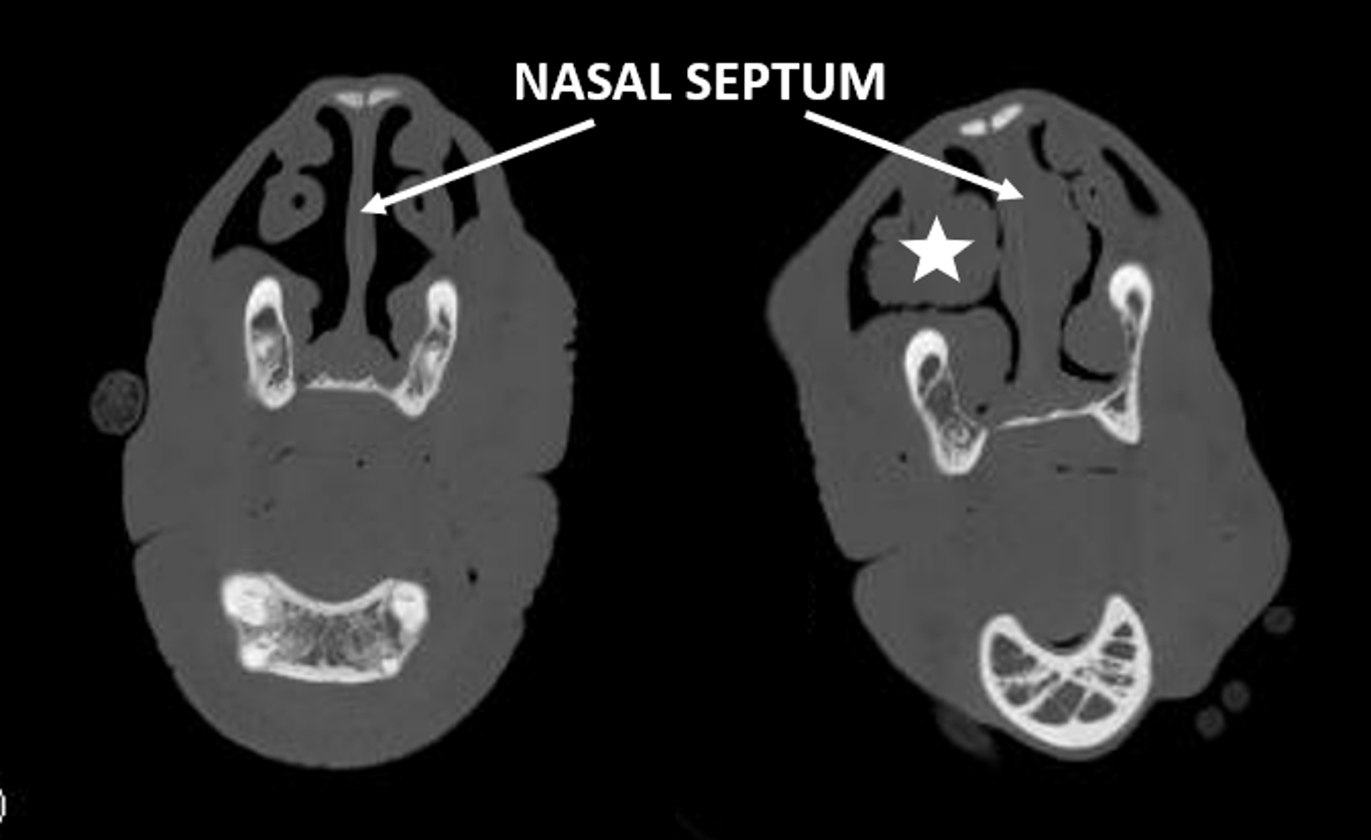 Nasal passages, horse (CT scan)