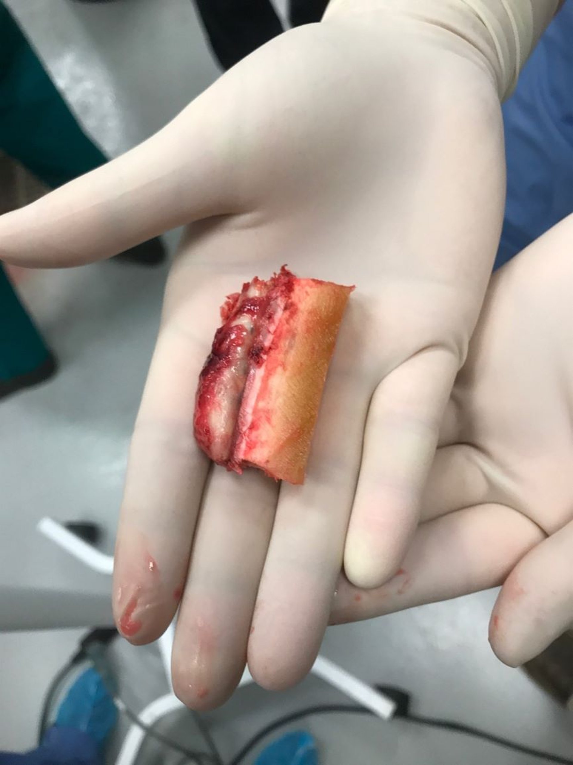 Queratoma cilíndrico, caballo