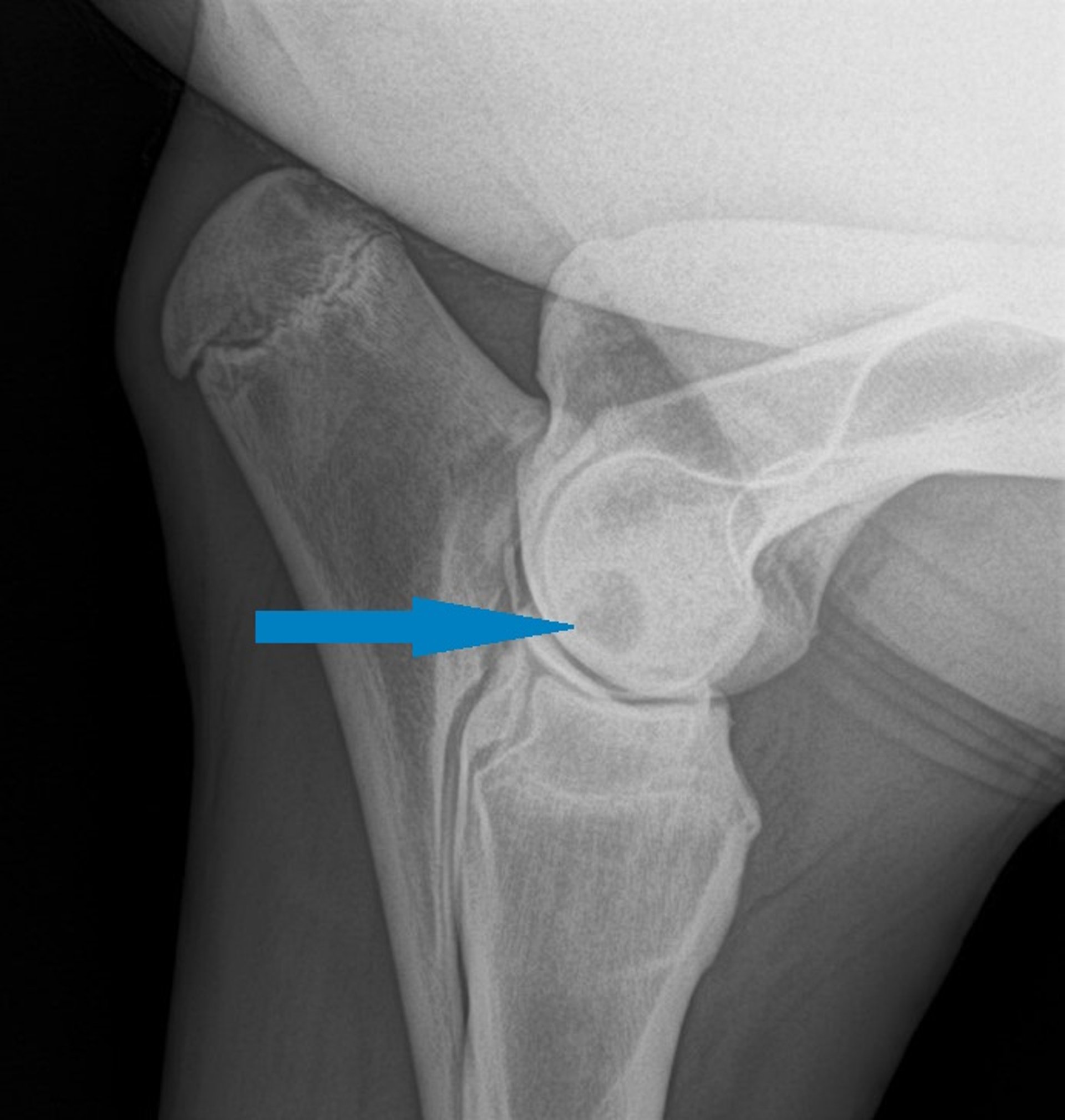 Cystlike lesion, distal humerus, radiograph, horse