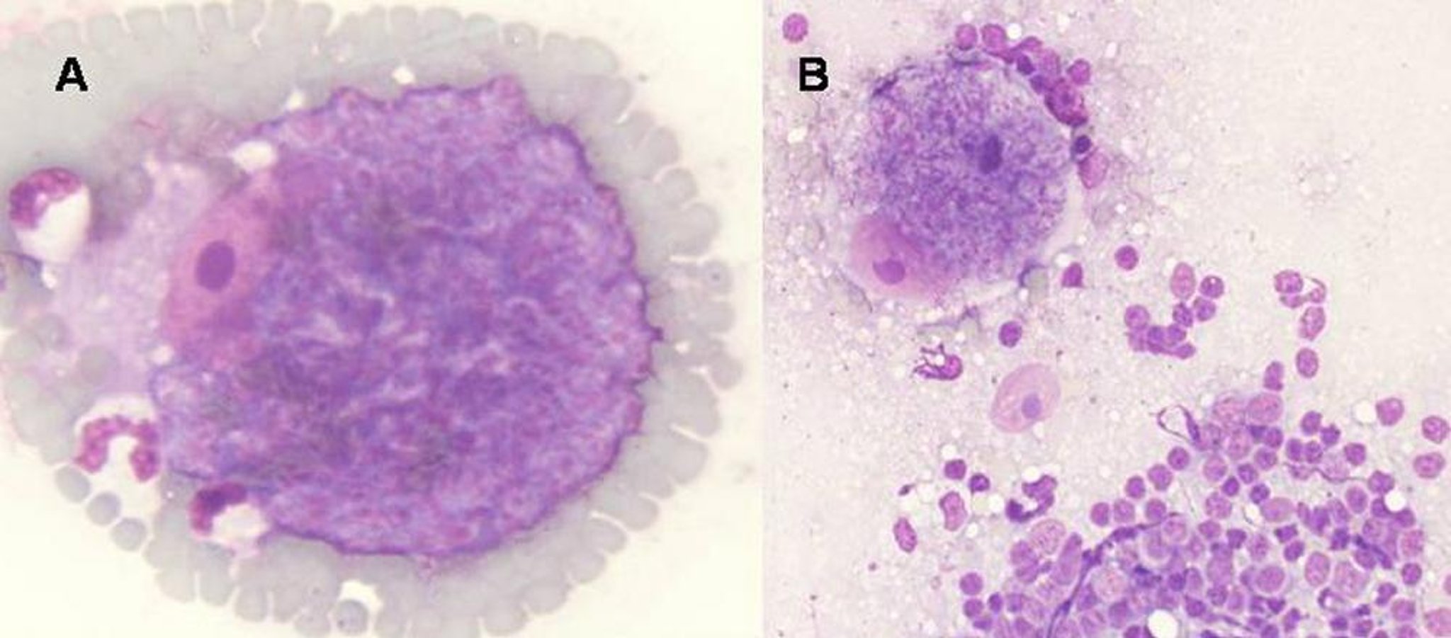 Esquizontes de <i >Cytauxzoon felis</i>, gato