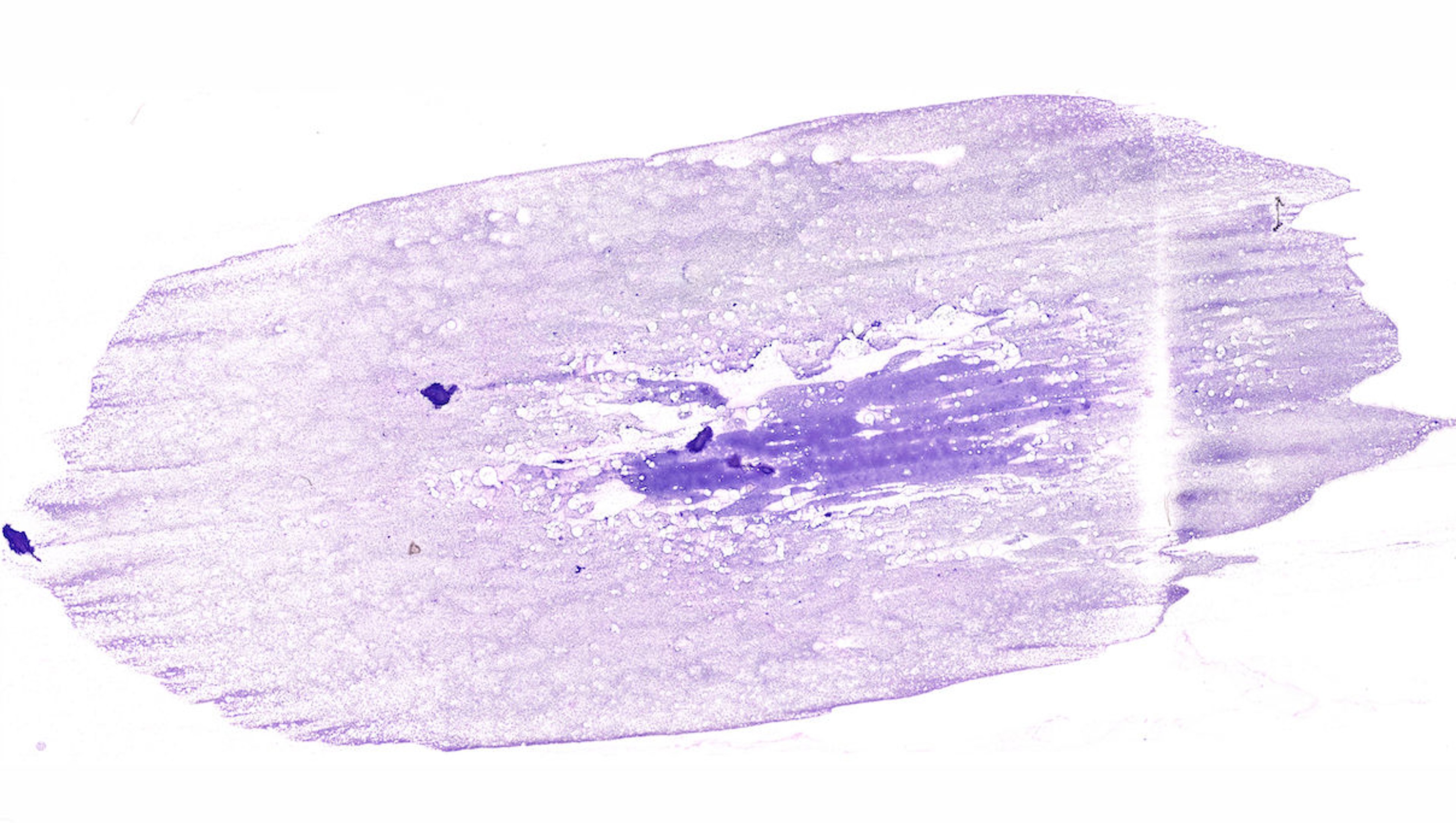Cytology smear with optimal preparation technique