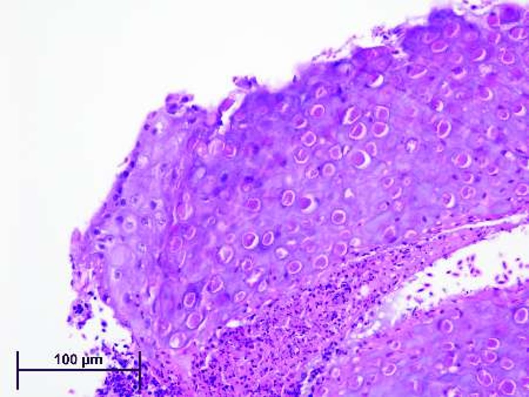 Cuerpos de inclusión citoplasmáticos en la infección por el virus de la viruela aviar