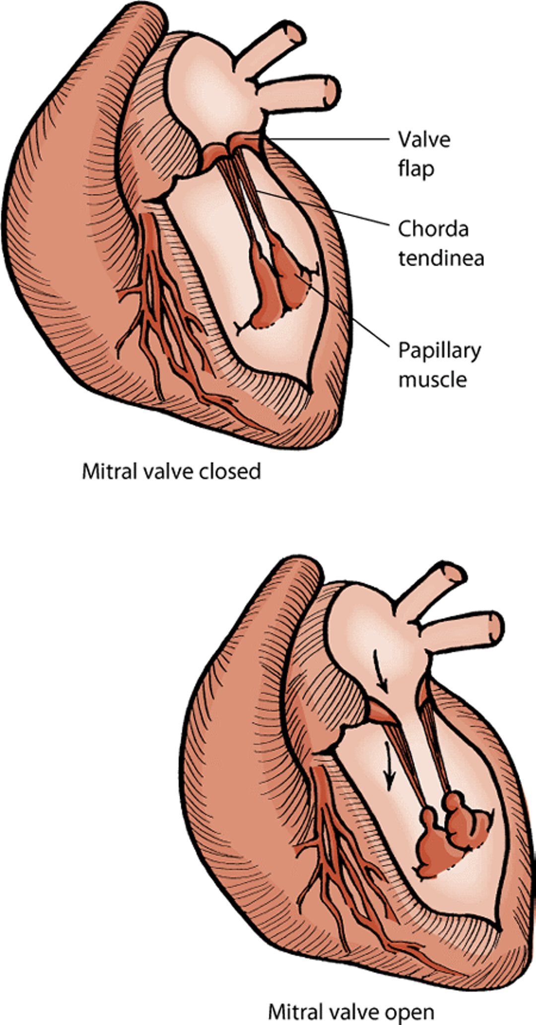 Mitral valve