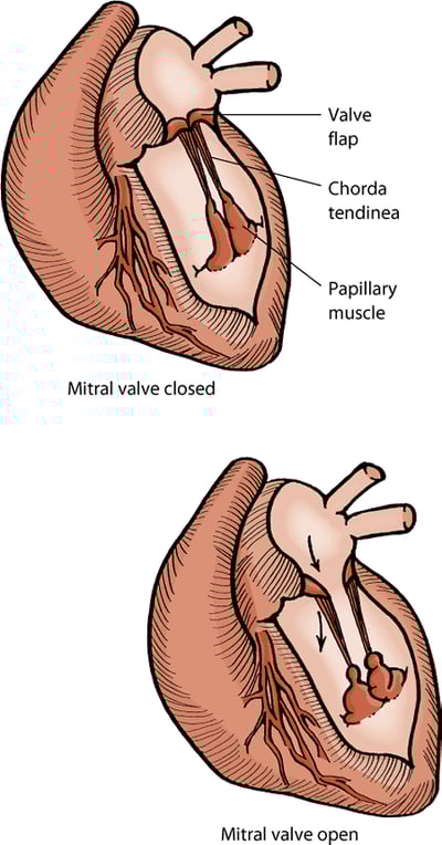 Mitral valve