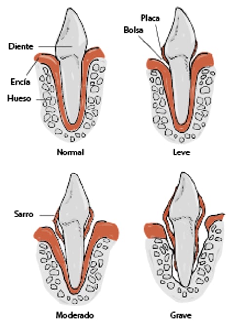 Progresión de la enfermedad periodontal en perros