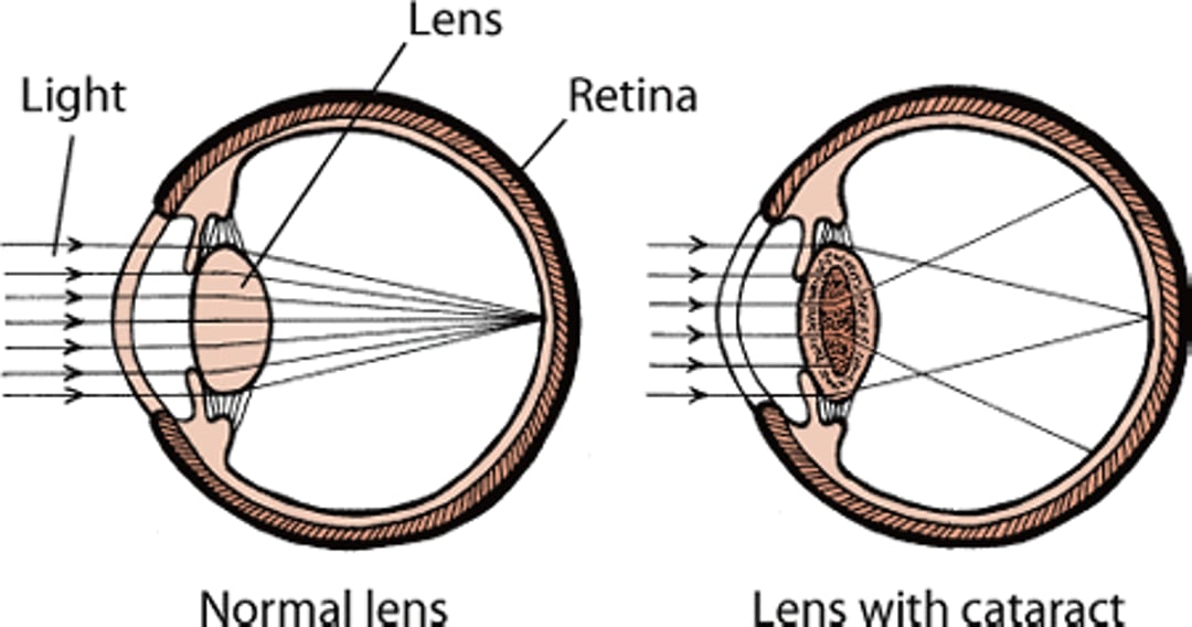 Lens with cataract, dog