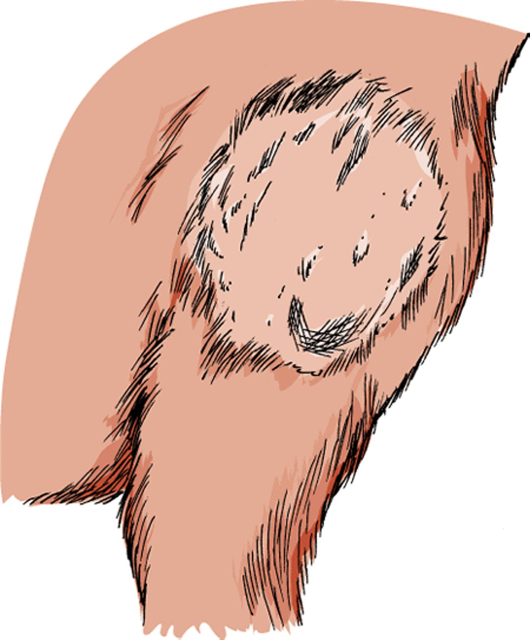Ringworm, dog