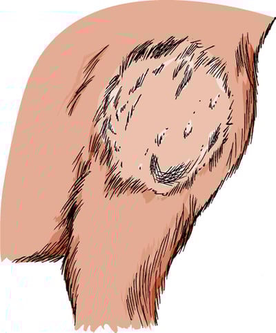 Ringworm, dog